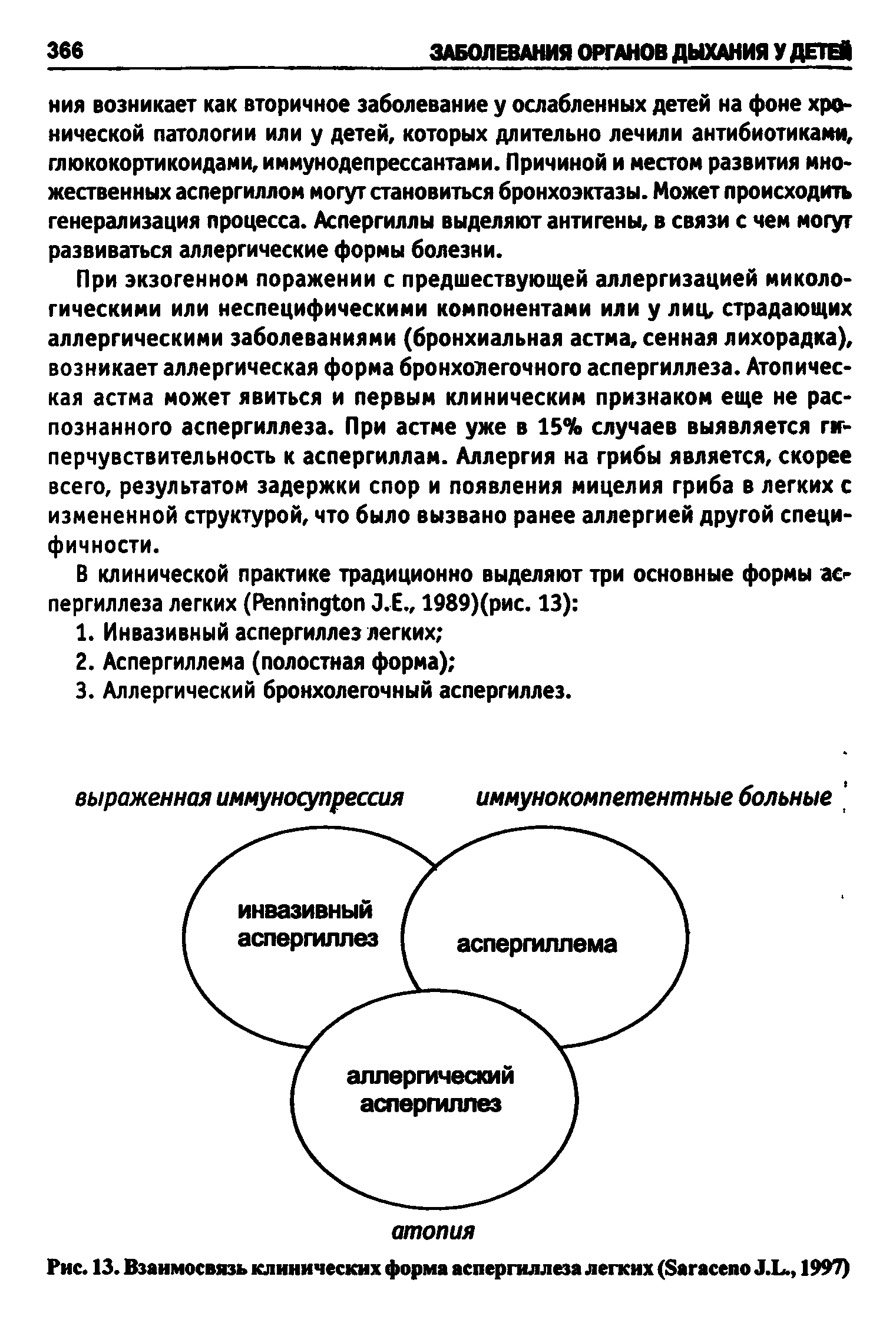 Рис. 13. Взаимосвязь клинических форма аспергиллеза легких (S J.L., 1997)...