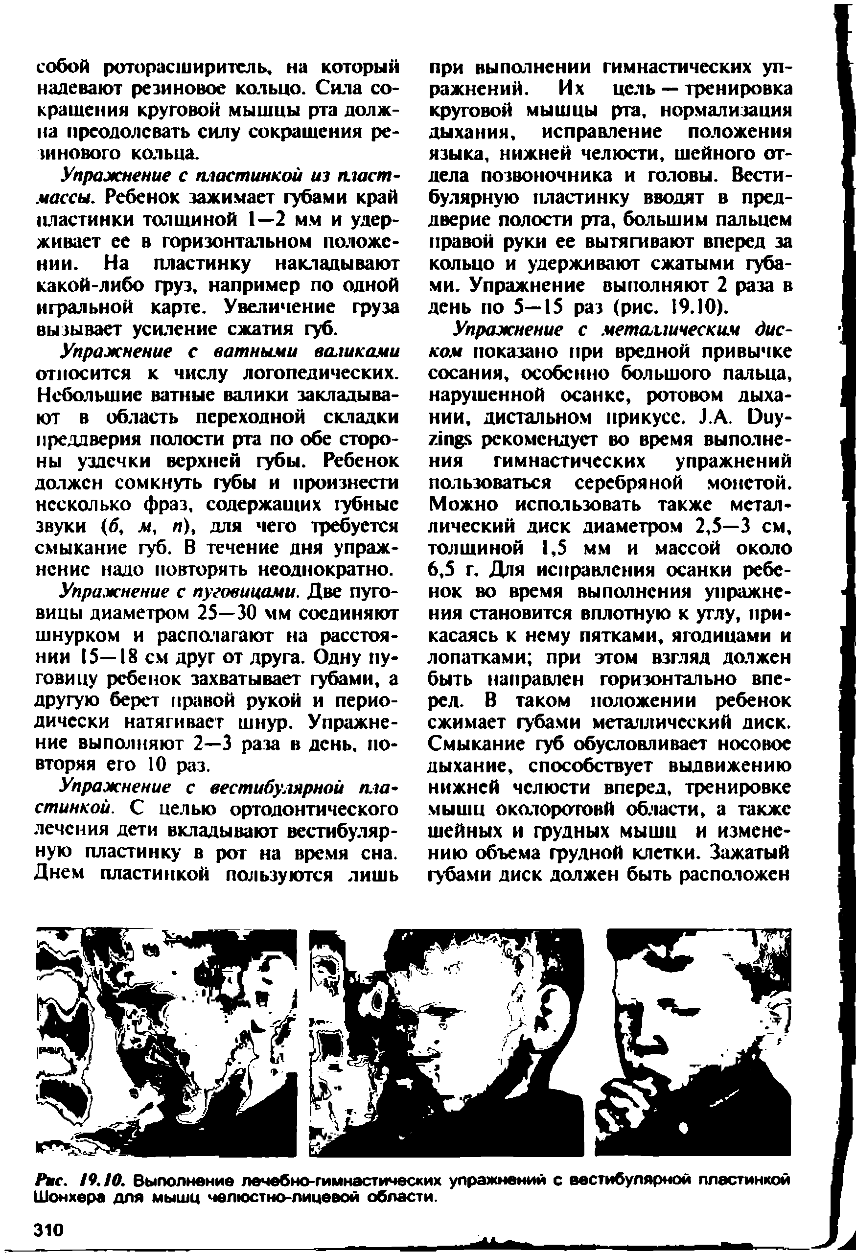 Рис. 19.10. Выполнение лечебно-гимнастических упражнений с вестибулярной пластинкой Шонхера для мышц челюстно-лицевой области.