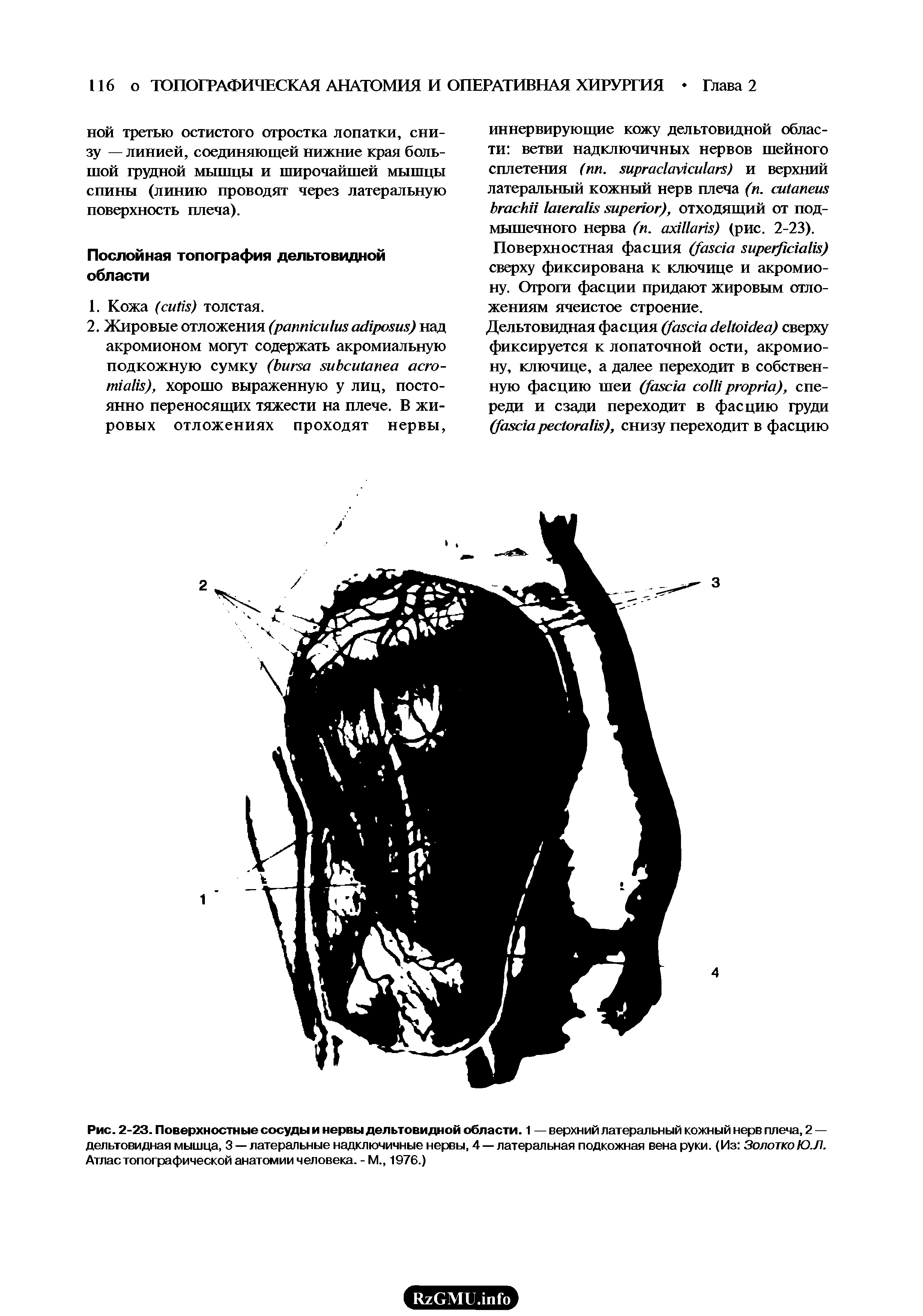 Рис. 2-23. Поверхностные сосуды и нервы дельтовидной области. 1 — верхний латеральный кожный нерв плеча, 2 — дельтовидная мышца, 3 — латеральные надключичные нервы, 4 — латеральная подкожная вена руки. (Из Золотко Ю.Л. Атлас топографической анатомии человека. - М., 1976.)...