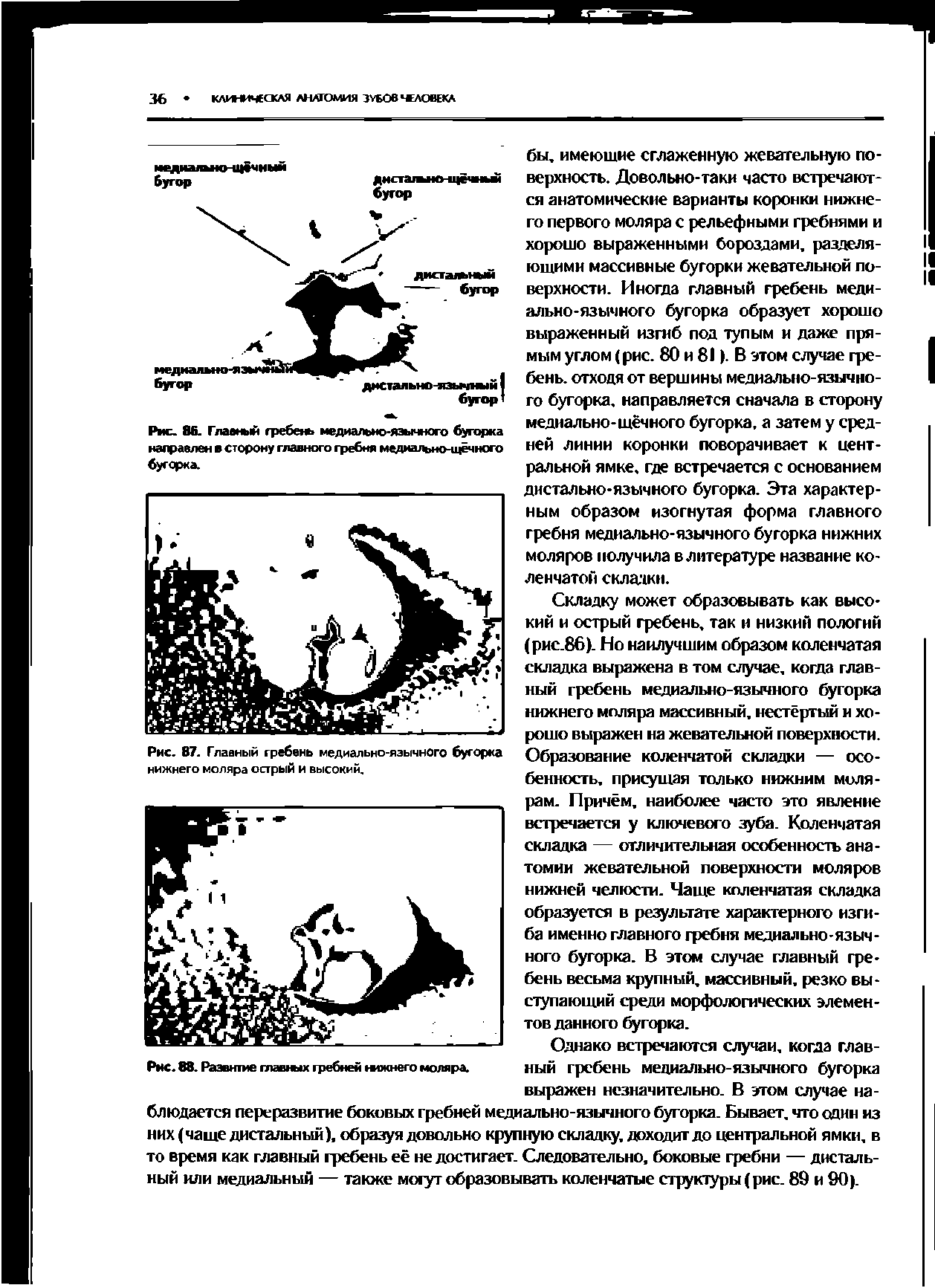 Рис. 87. Главный гребень медиально-язычного бугорка нижнего моляра острый и высокий.