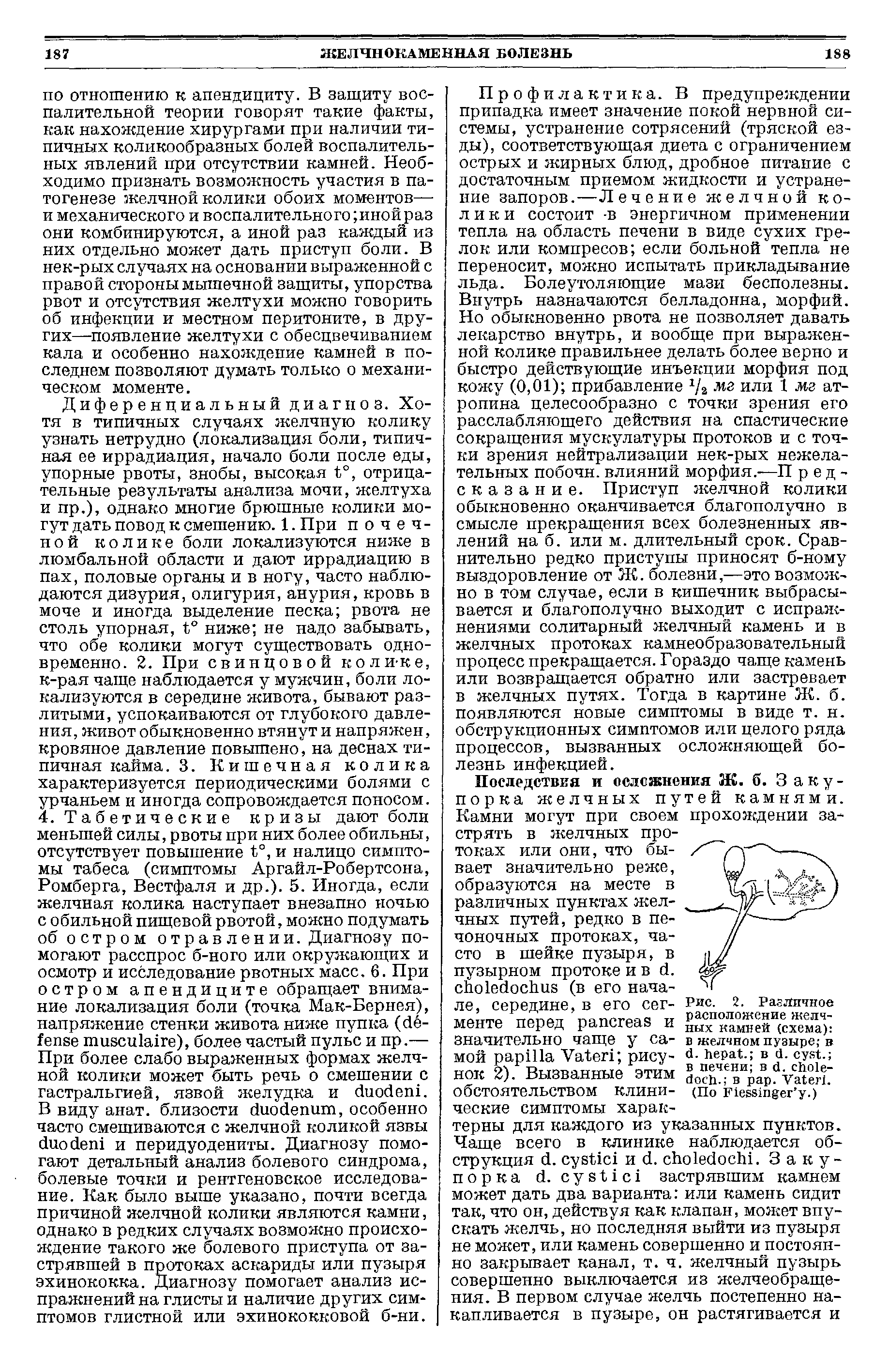 Рис. 2. Рав Личное расположение желчных камней (схема) в желчном пузыре в . . в . . в печени в . . в . V .