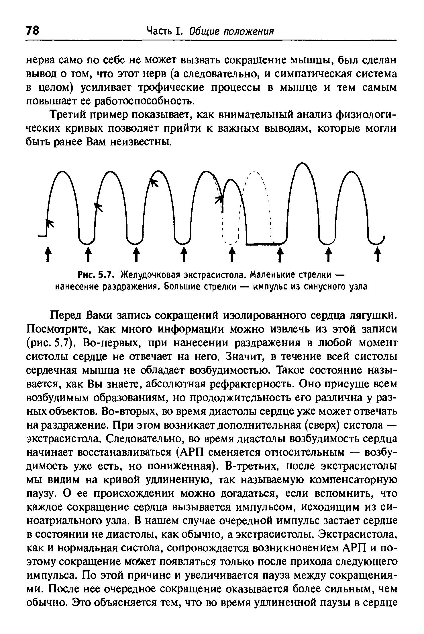 Рис. 5.7. Желудочковая экстрасистола. Маленькие стрелки — нанесение раздражения. Большие стрелки — импульс из синусного узла...