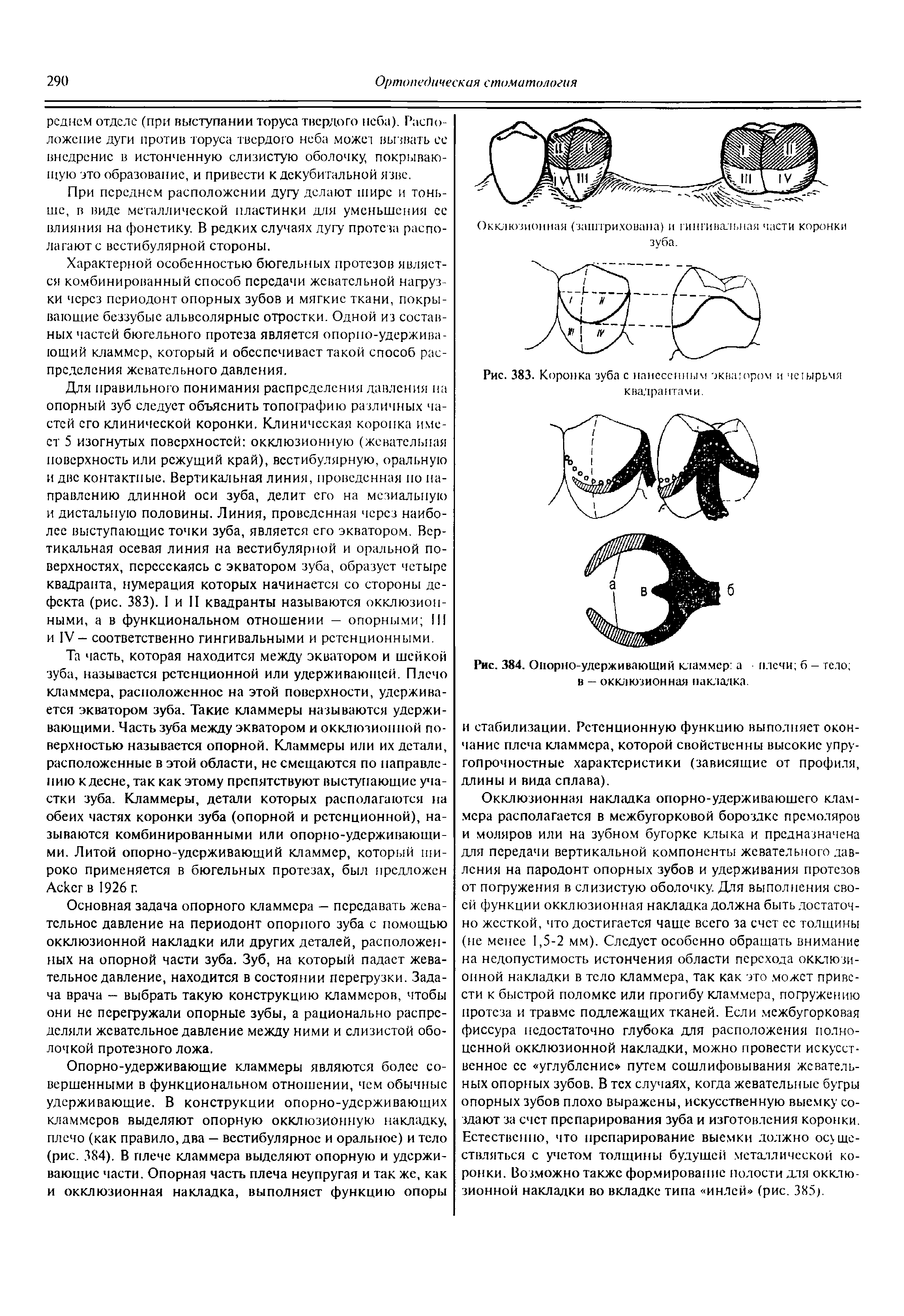 Рис. 384. Опорно-удерживающий кламмер а плечи 6 - тело в — окклюзионная накладка.