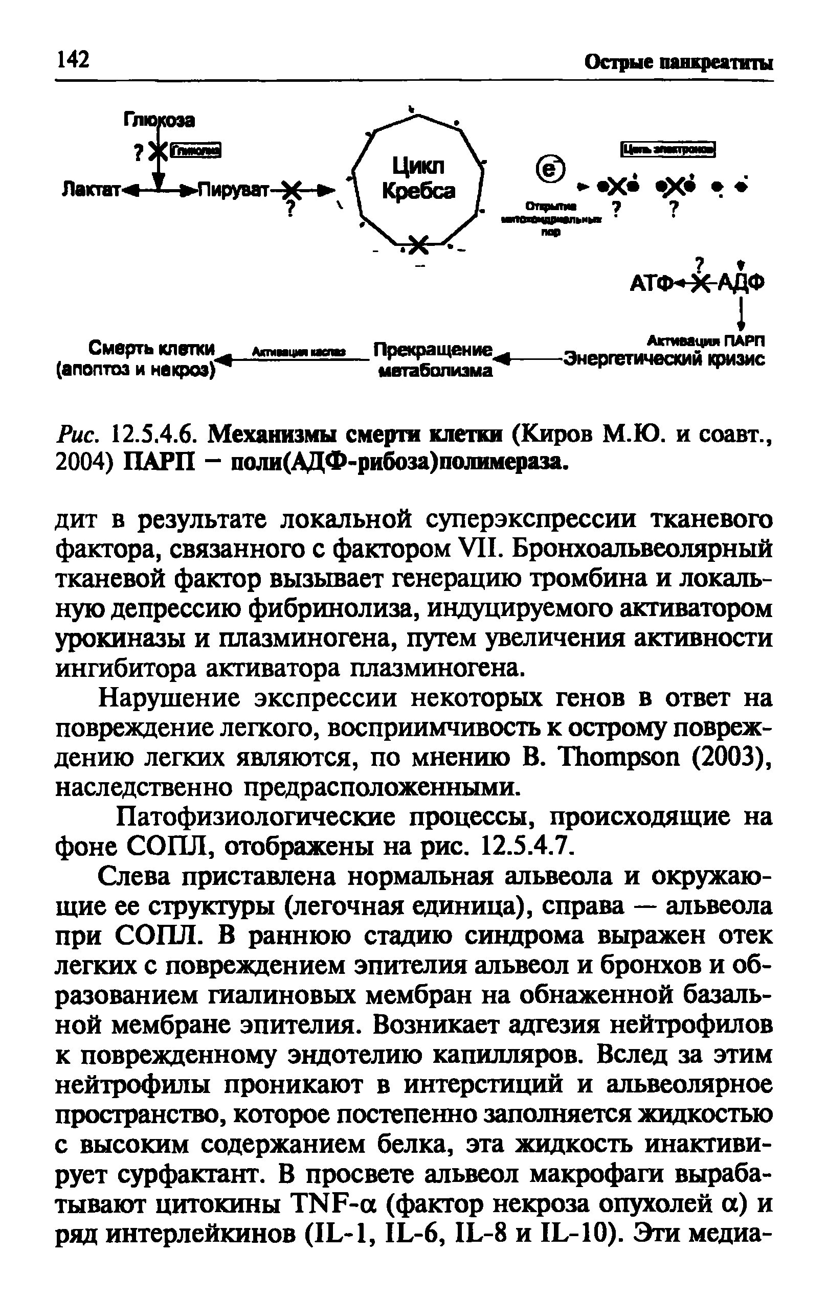 Рис. 12.5.4.6. Механизмы смерти клетки (Киров М.Ю. и соавт., 2004) ПАРП - поли(АДФ-рибоза)полимераза.