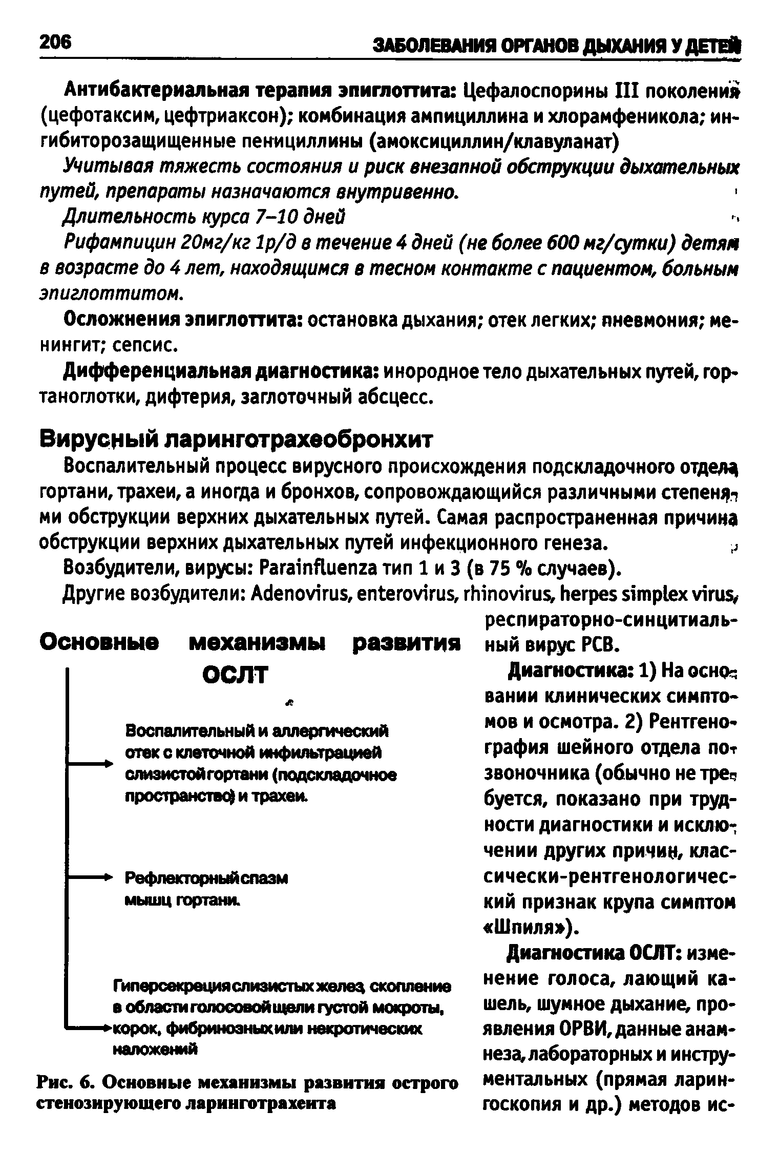 Рис. 6. Основные механизмы развития острого стенозирующего ларинготрахеита...