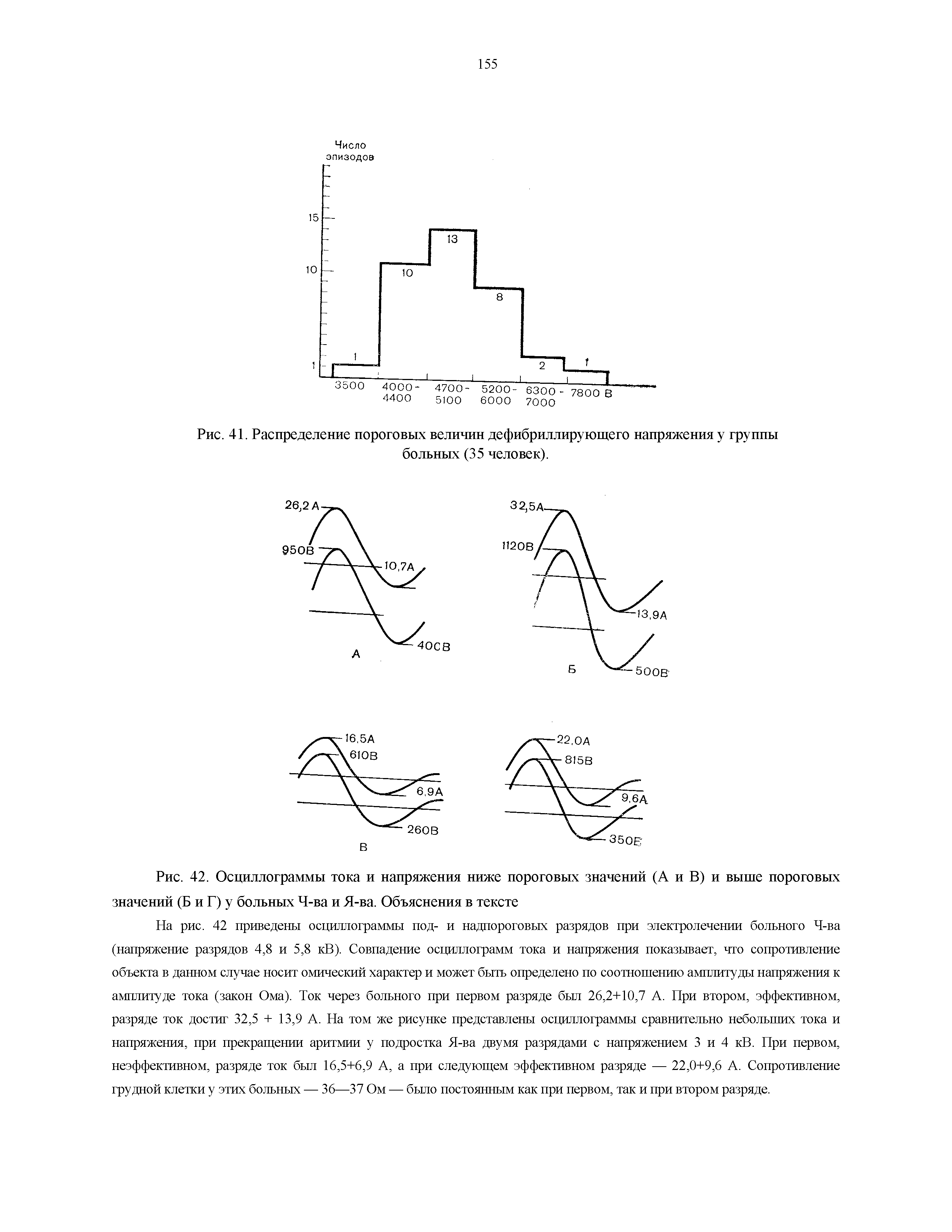 Рис. 41. Распределение пороговых величин дефибриллирующего напряжения у группы больных (35 человек).