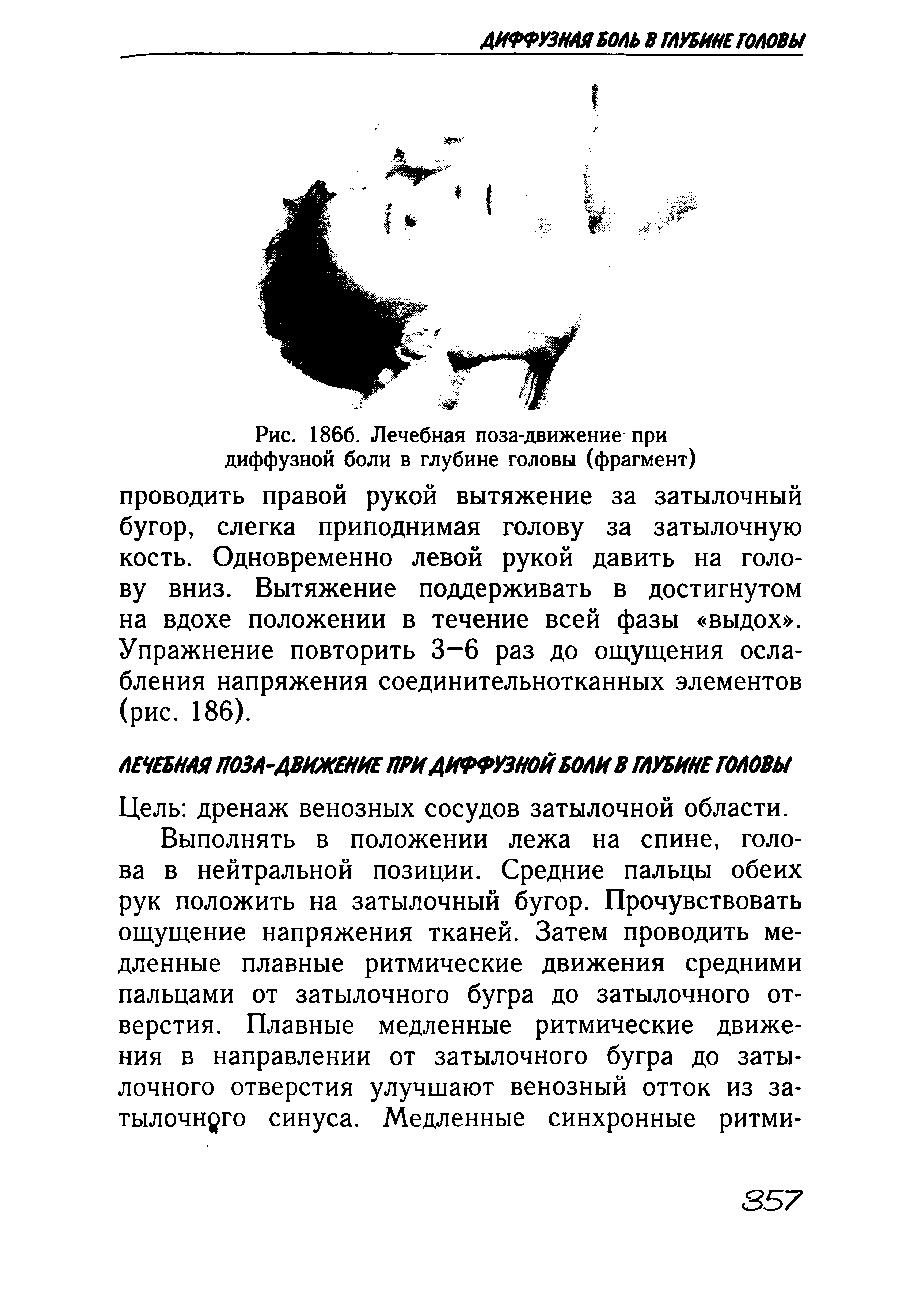 Рис. 1866. Лечебная поза-движение при диффузной боли в глубине головы (фрагмент) проводить правой рукой вытяжение за затылочный бугор, слегка приподнимая голову за затылочную кость. Одновременно левой рукой давить на голову вниз. Вытяжение поддерживать в достигнутом на вдохе положении в течение всей фазы выдох . Упражнение повторить 3-6 раз до ощущения ослабления напряжения соединительнотканных элементов (рис. 186).