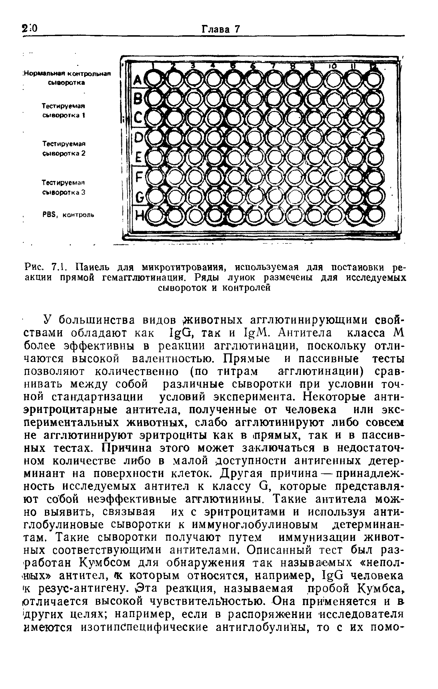 Рис. 7.1. Панель для микротитроваиия, используемая для постановки реакции прямой гемагглютинации. Ряды лунок размечены для исследуемых сывороток и контролей...