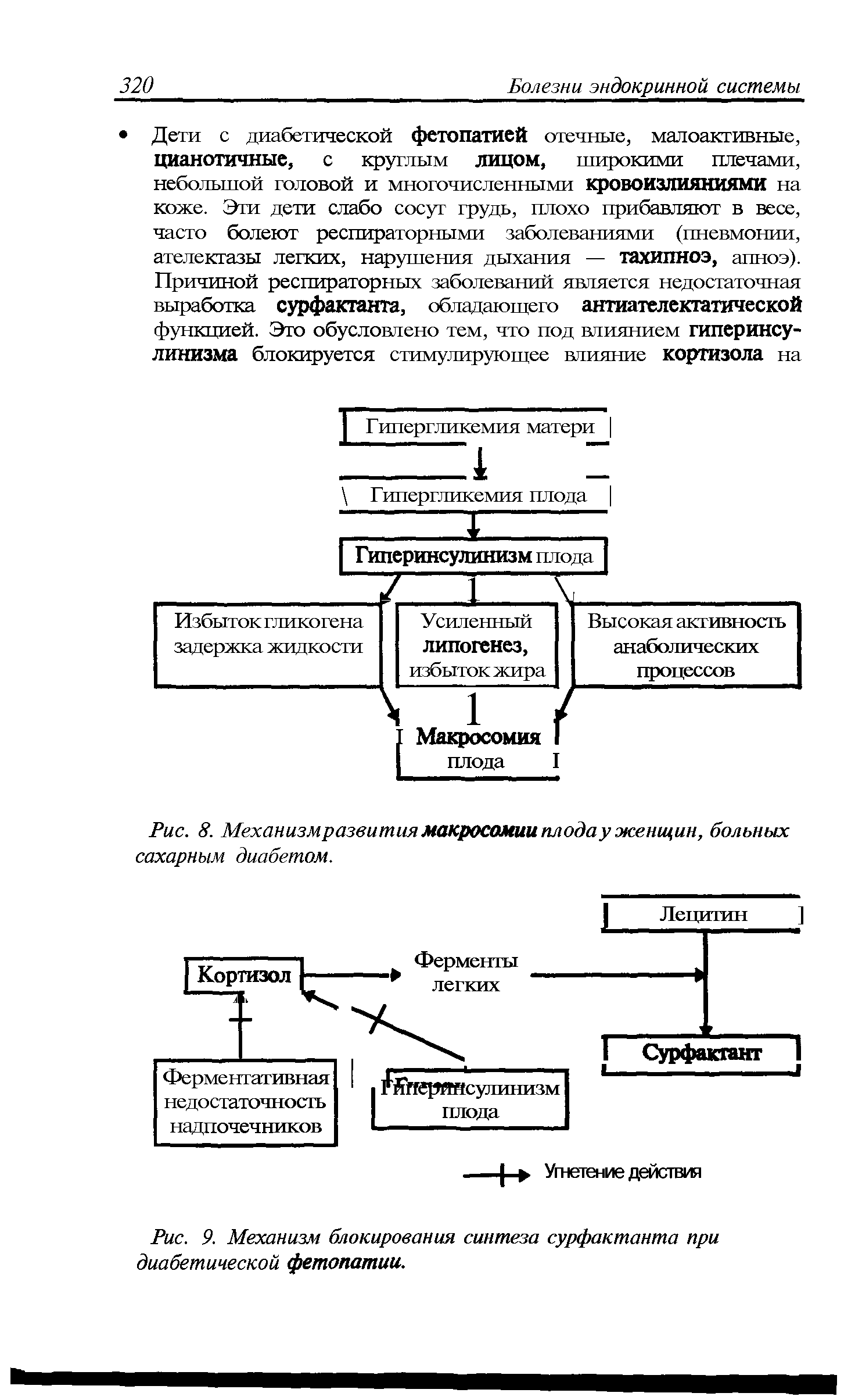 Рис. 9. Механизм блокирования синтеза сурфактанта при диабетической фетопатии.