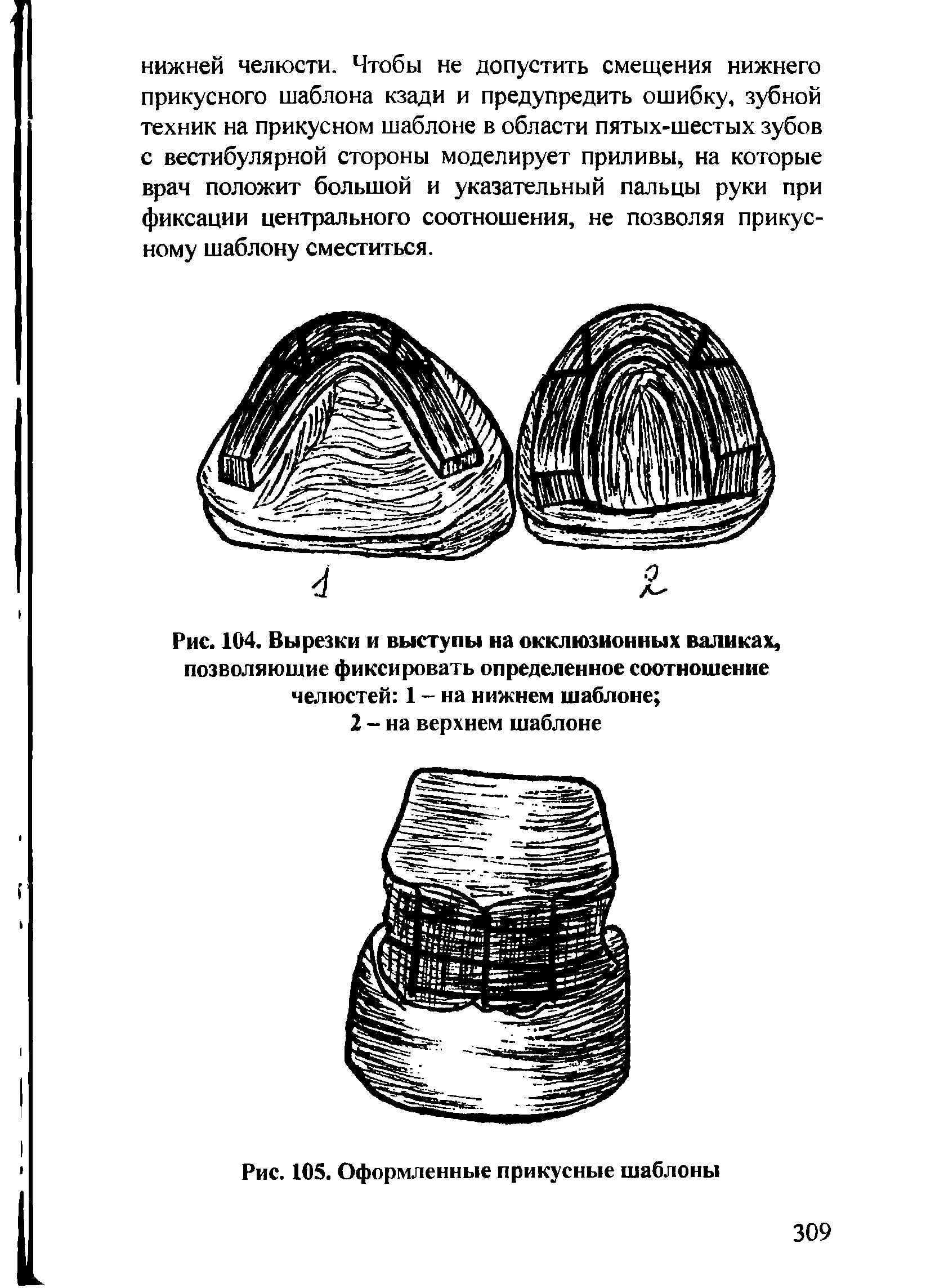 Рис. 104. Вырезки и выступы на окклюзионных валиках, позволяющие фиксировать определенное соотношение челюстей 1 - на нижнем шаблоне ...