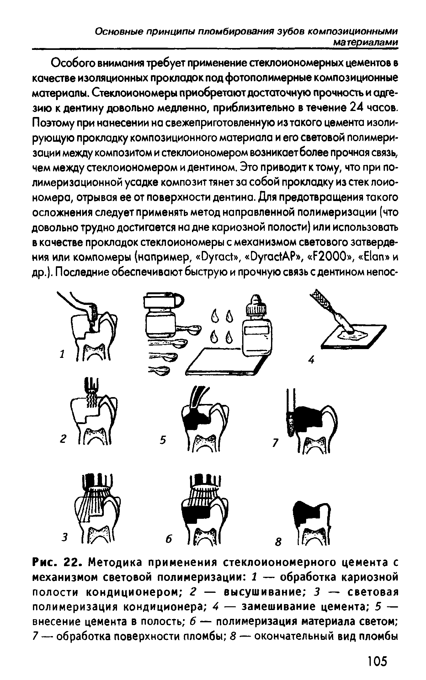 Рис. 22. Методика применения стеклоиономерного цемента с механизмом световой полимеризации 1 — обработка кариозной полости кондиционером 2 — высушивание 3 — световая полимеризация кондиционера 4 — замешивание цемента 5 — внесение цемента в полость 6 — полимеризация материала светом 7 — обработка поверхности пломбы 8 — окончательный вид пломбы...