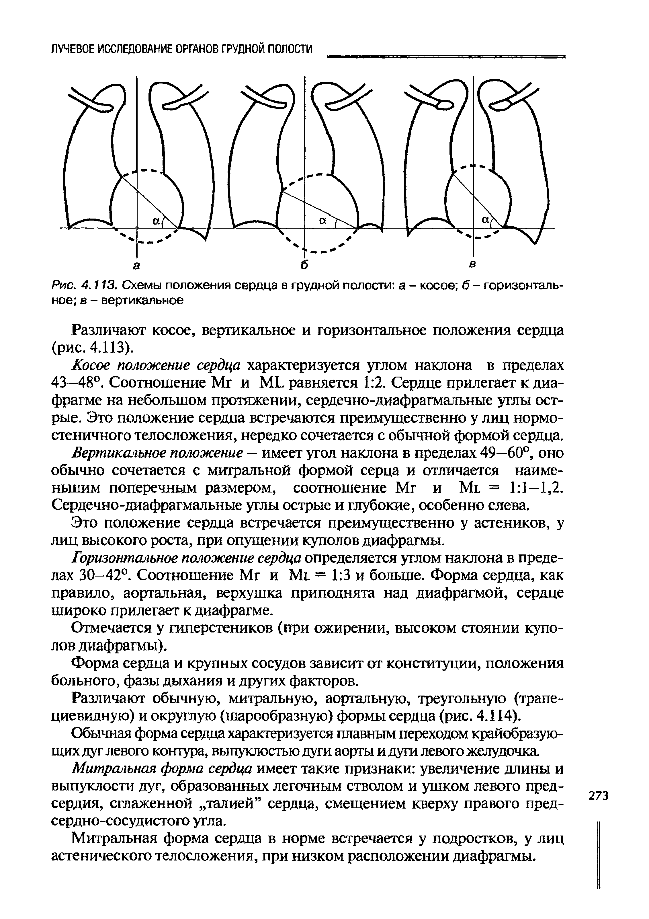 Рис. 4.113. Схемы положения сердца в грудной полости а - косое б - горизонтальное в - вертикальное...