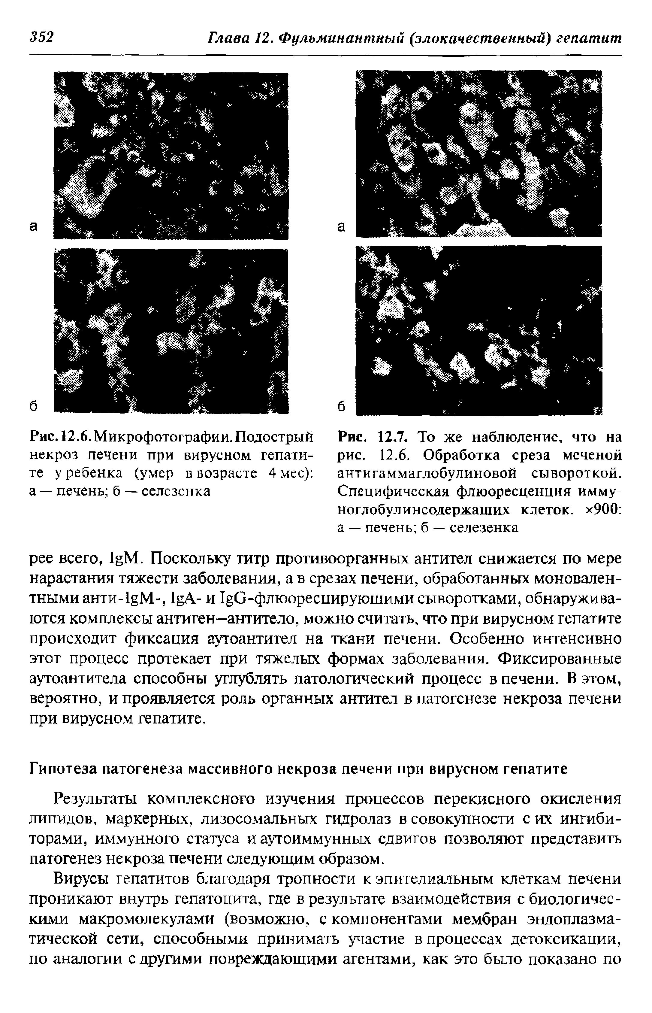 Рис. 12.7. То же наблюдение, что на рис. 12.6. Обработка среза меченой анти гам матлобулиновой сывороткой. Специфическая флюоресценция имму-ноглобулинсодержаших клеток. х900 а — печень б — селезенка...