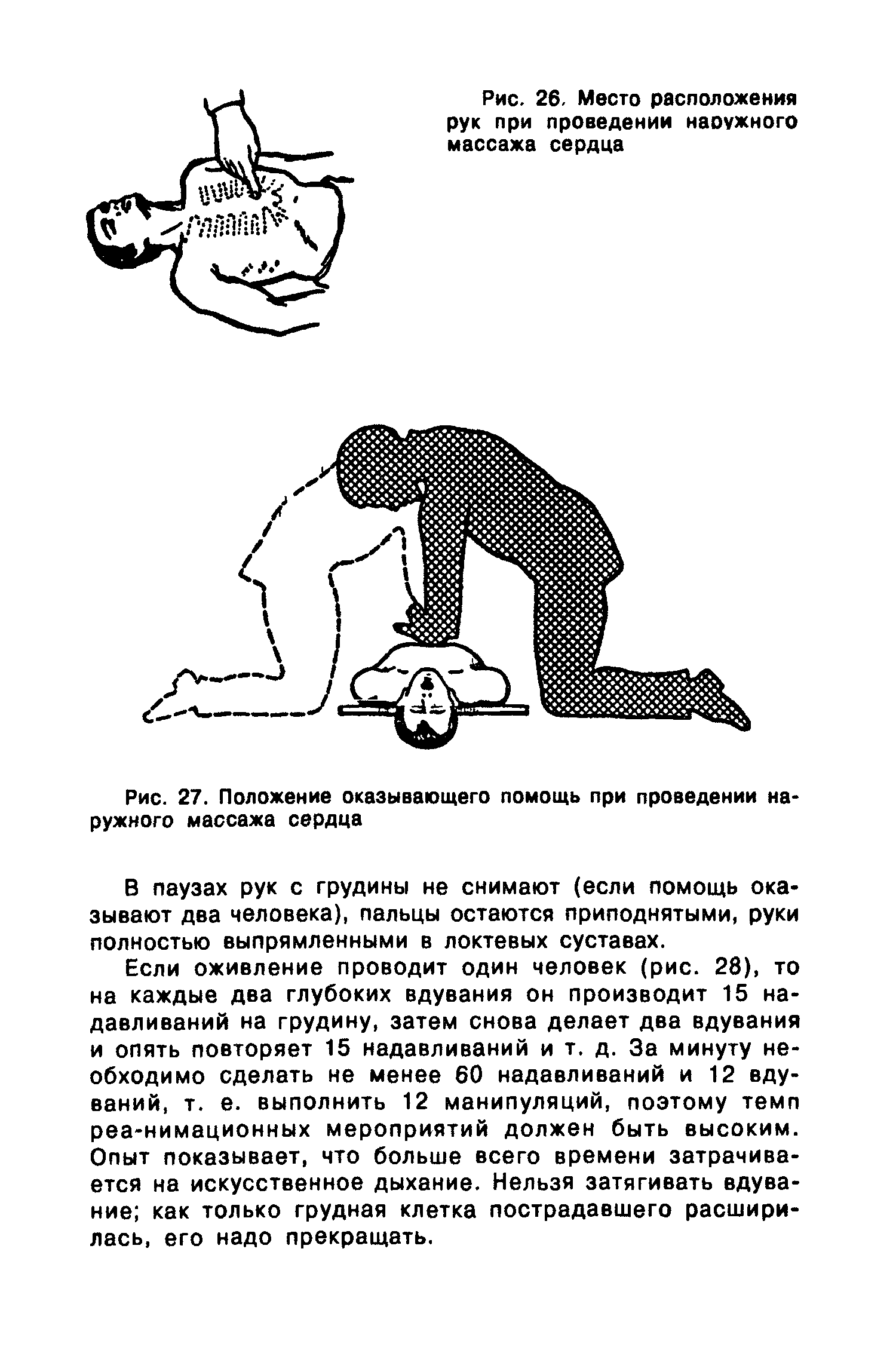 Рис. 27. Положение оказывающего помощь при проведении наружного массажа сердца...