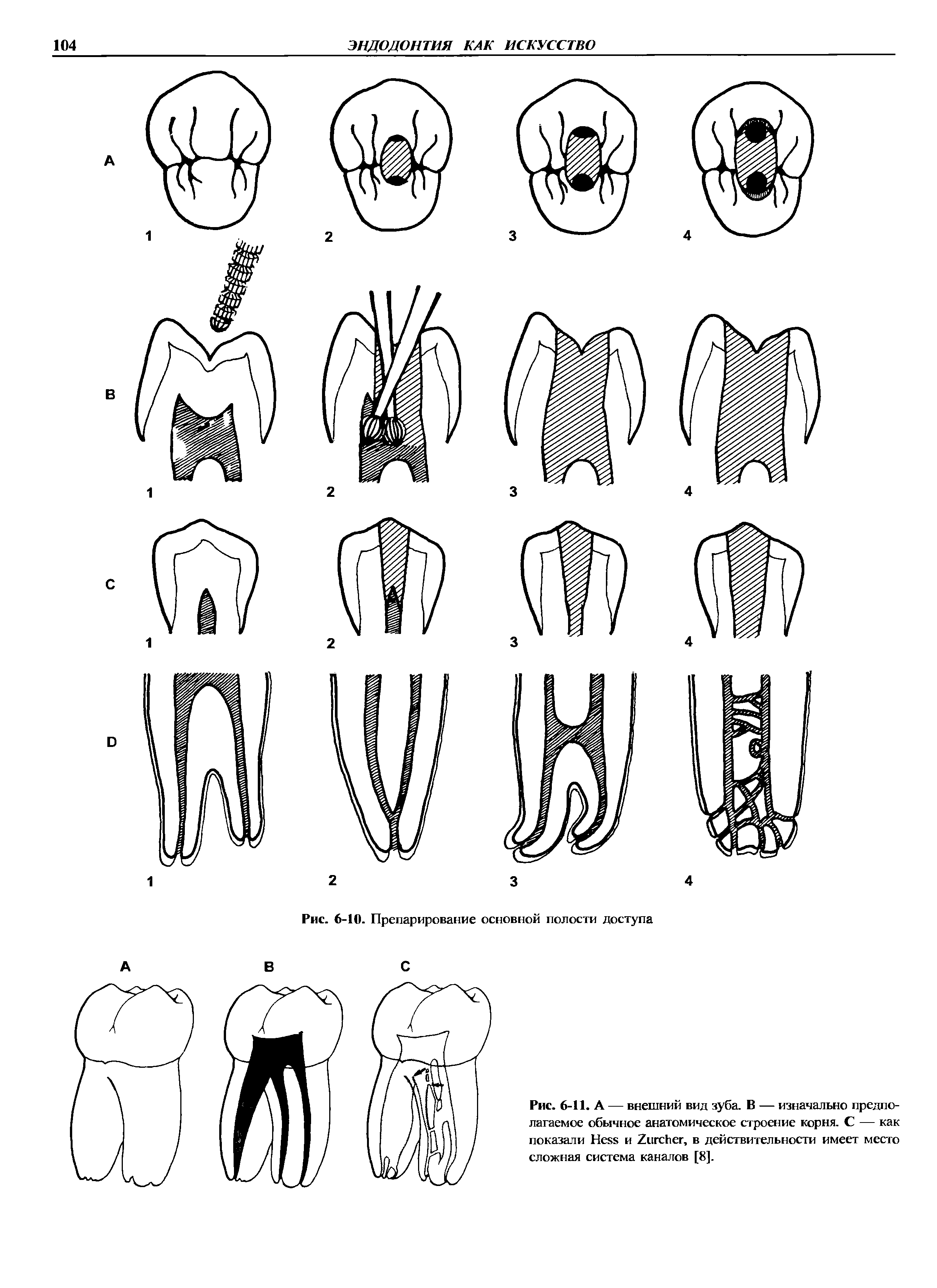 Рис. 6-11. А — внешний вид зуба. В — изначально предполагаемое обычное анатомическое строение корня. С — как показали H и Z , в действительности имеет место сложная система каналов [8].