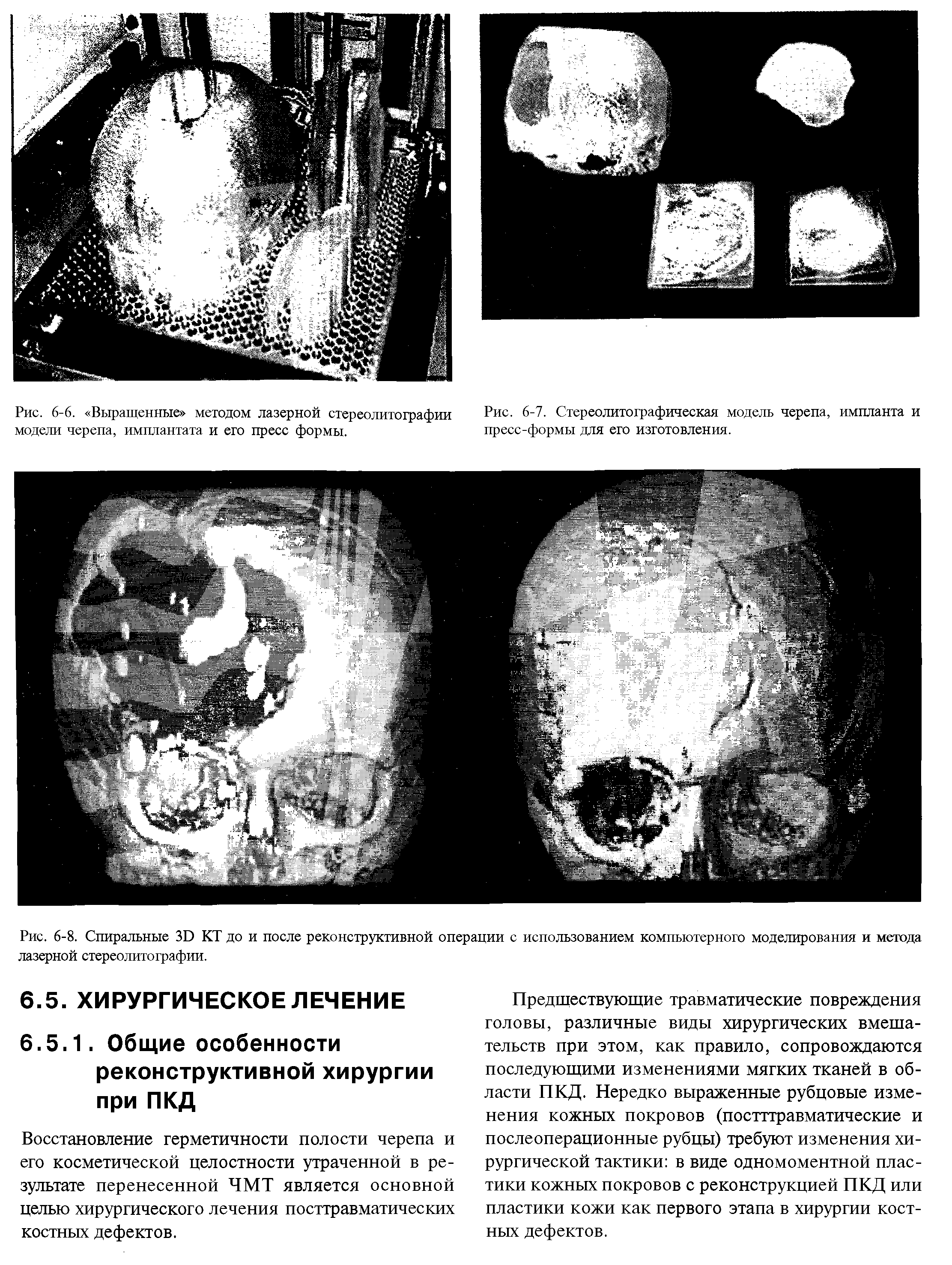 Рис. 6-6. Выращенные методом лазерной стереолитографии модели черепа, имплантата и его пресс формы.