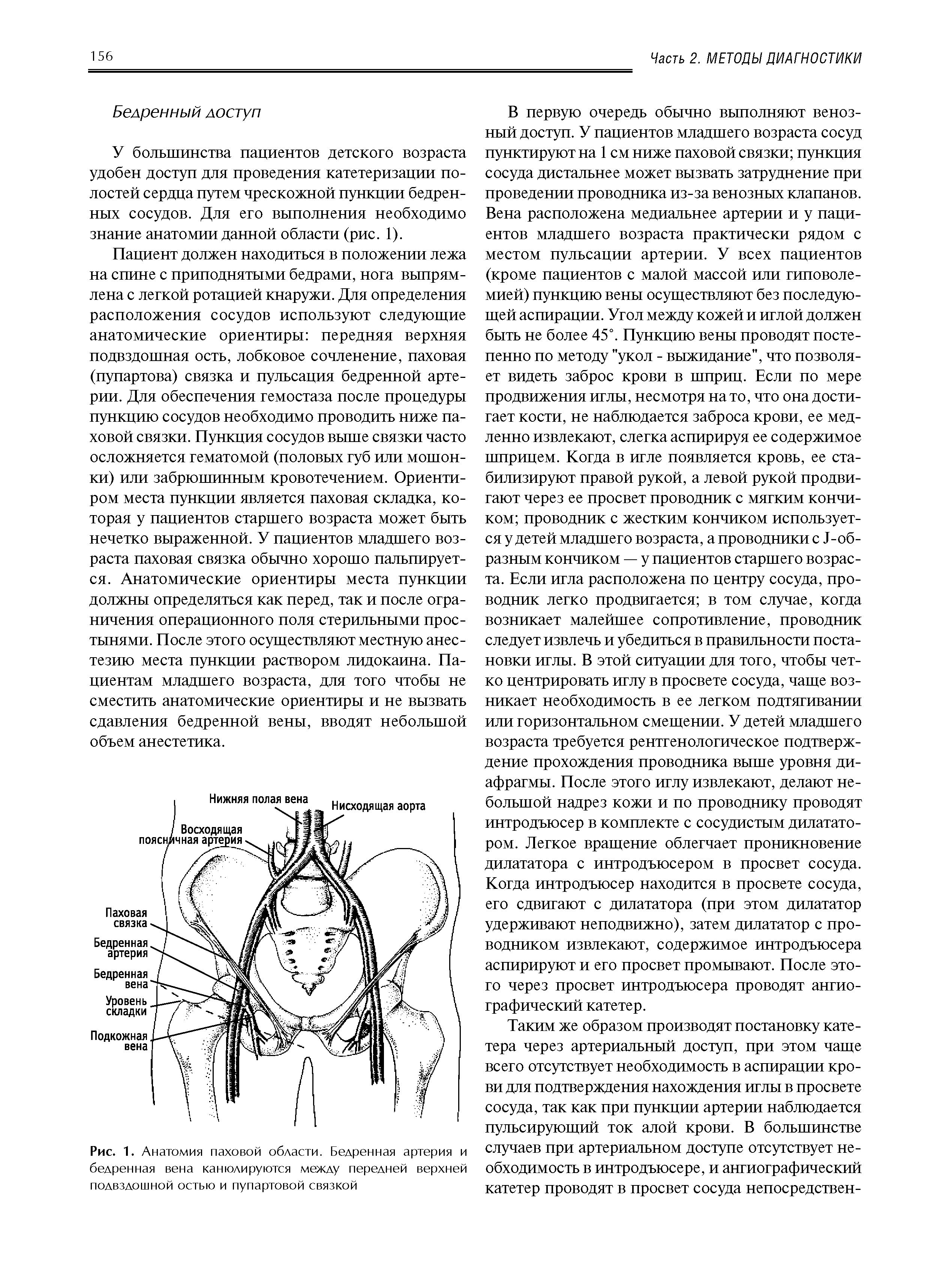 Рис. 1. Анатомия паховой области. Бедренная артерия и бедренная вена канюлируются между передней верхней подвздошной остью и пупартовой связкой...