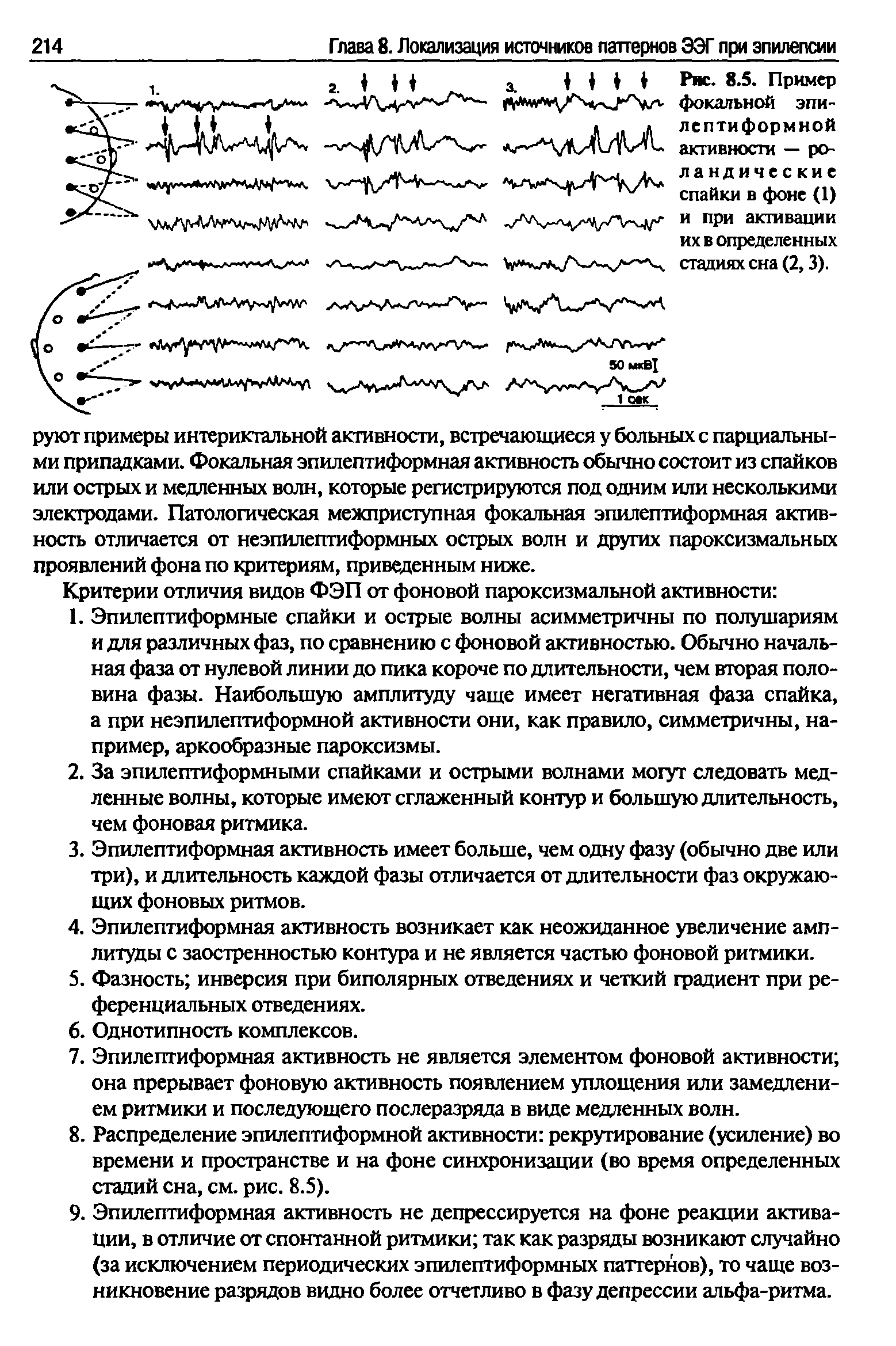 Рис. 8.5. Пример фокальной эпилептиформной активности — ро-ландические спайки в фоне (1) и при активации их в определенных стадиях сна (2,3).