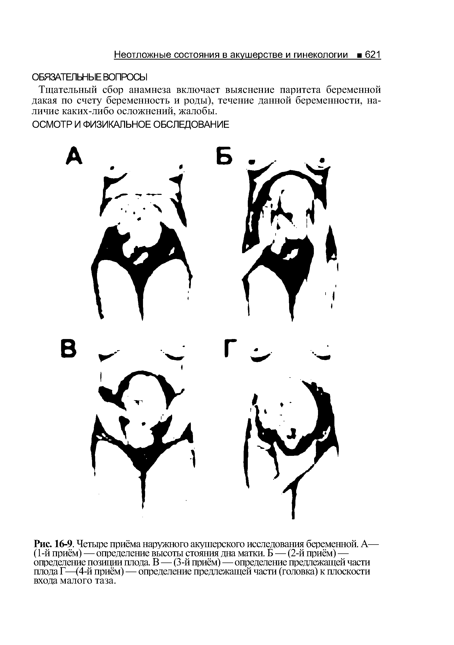 Рис. 16-9. Четыре приёма наружного акушерского исследования беременной. А— (1-й приём) — определение высоты стояния дна матки. Б — (2-й приём) — определение позиции плода. В — (3-й приём)—определение предлежащей части плода Г—(4-й приём) — определение предлежащей части (головка) к плоскости входа малого таза.