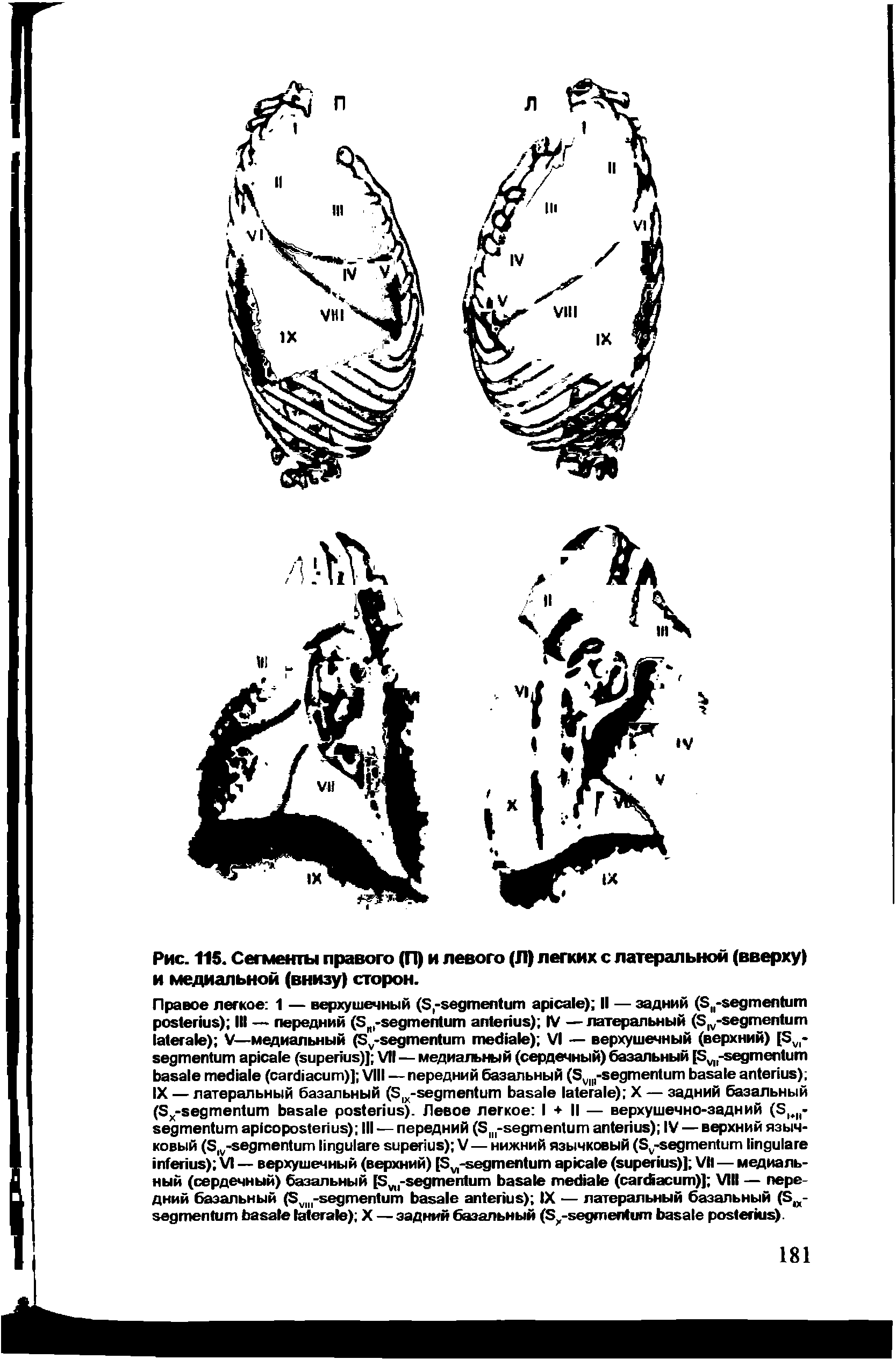 Рис. 11S. Сегменты правого (П) и левого (Л) легких с латеральной (вверху) и медиальной (внизу) сторон.