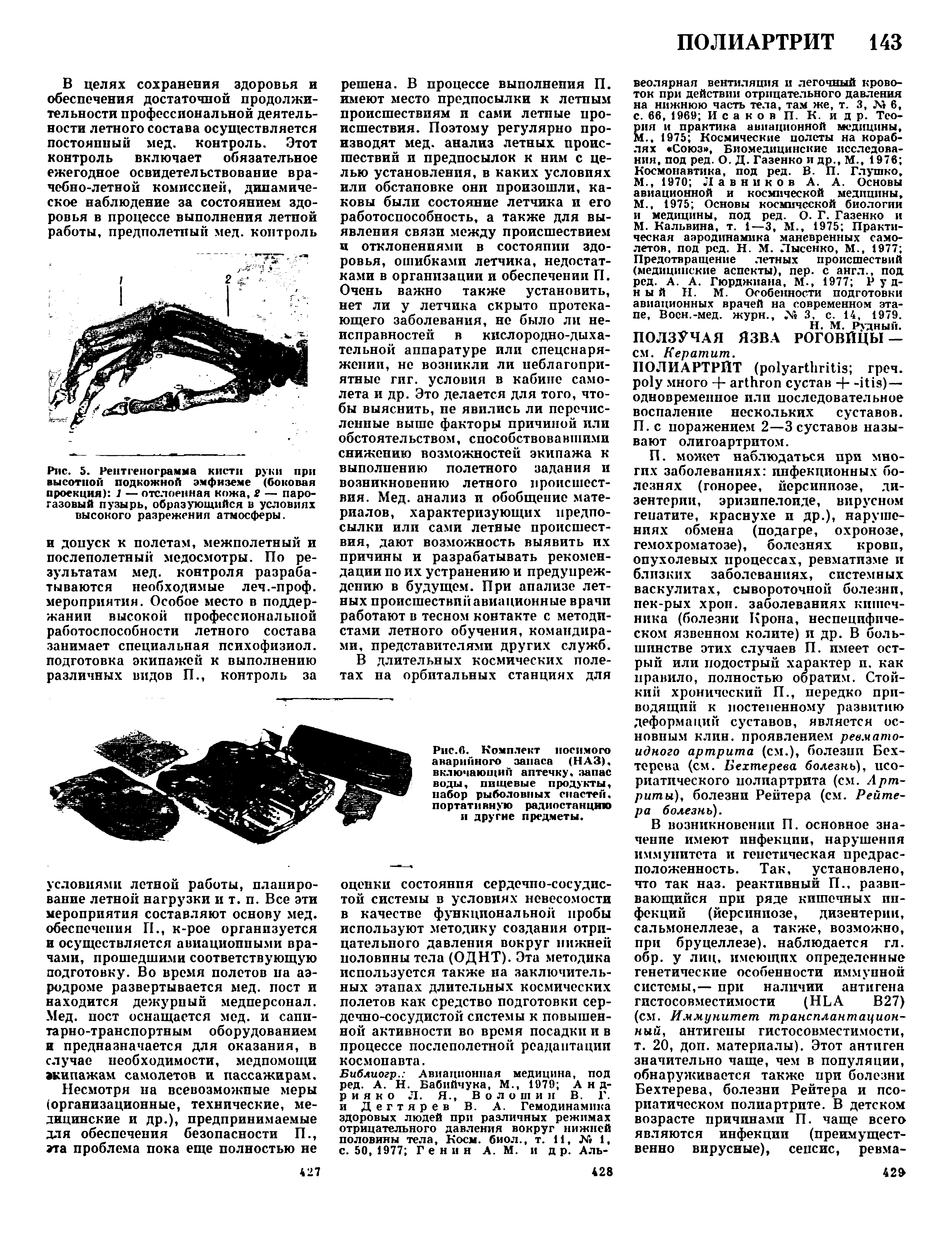 Рис. 5. Рентгенограмма кисти руки при высотной подкожной эмфиземе (боковая проекция) 1 — отслоенная кожа, 2 — парогазовый пузырь, образующийся в условиях высокого разрежения атмосферы.