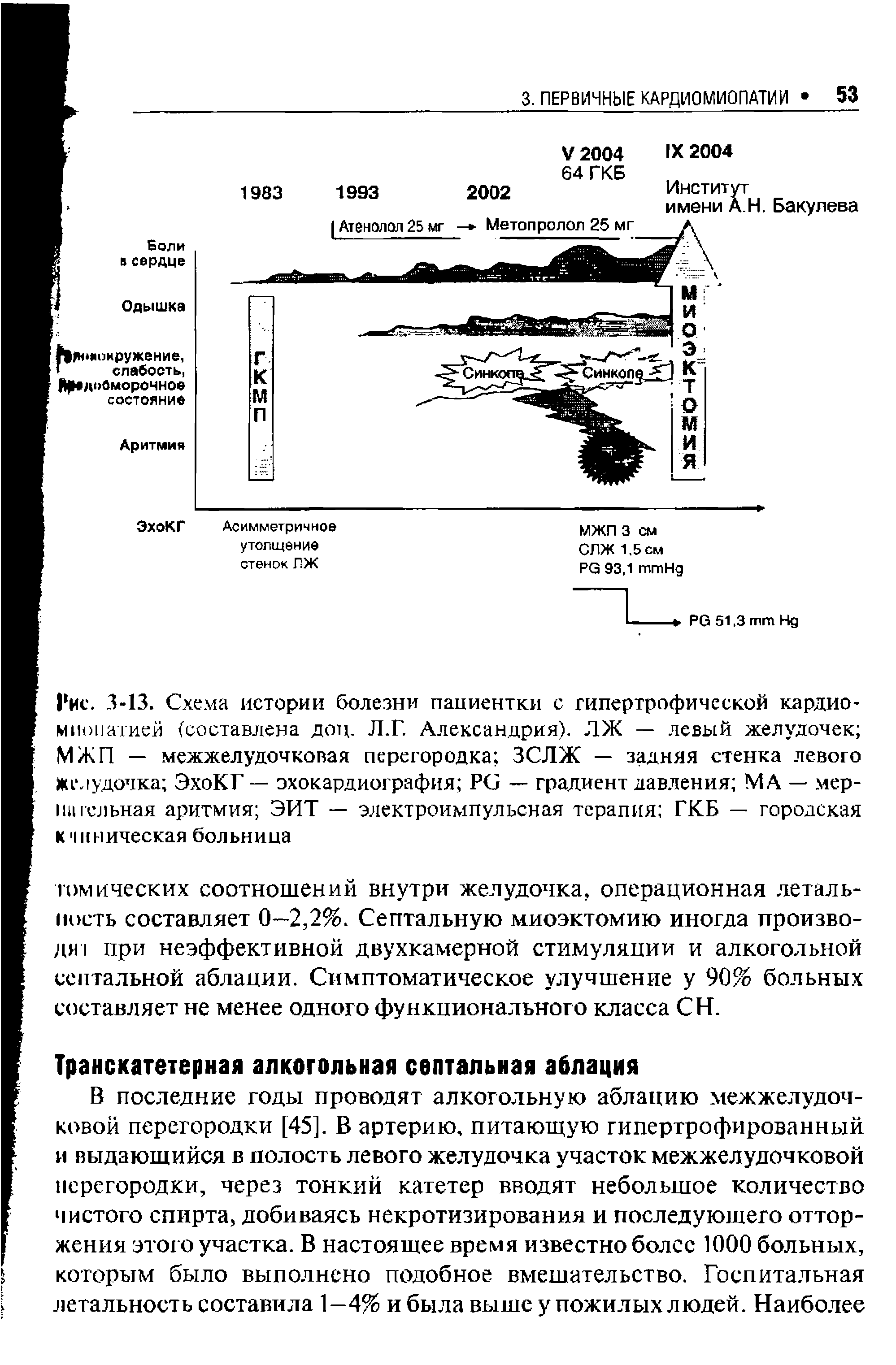 Рис. 3 -13. Схема истории болезни пациентки с гипертрофической кардио-миопатией (составлена доц. Л.Г. Александрия). ЛЖ — левый желудочек МЖП — межжелудочковая перегородка ЗСЛЖ — задняя стенка левого желудочка ЭхоКГ — эхокардиография PG — градиент давления МА — мер-нагельная аритмия ЭИТ — электроимпульсная терапия ГКБ — городская В к ническая больница...