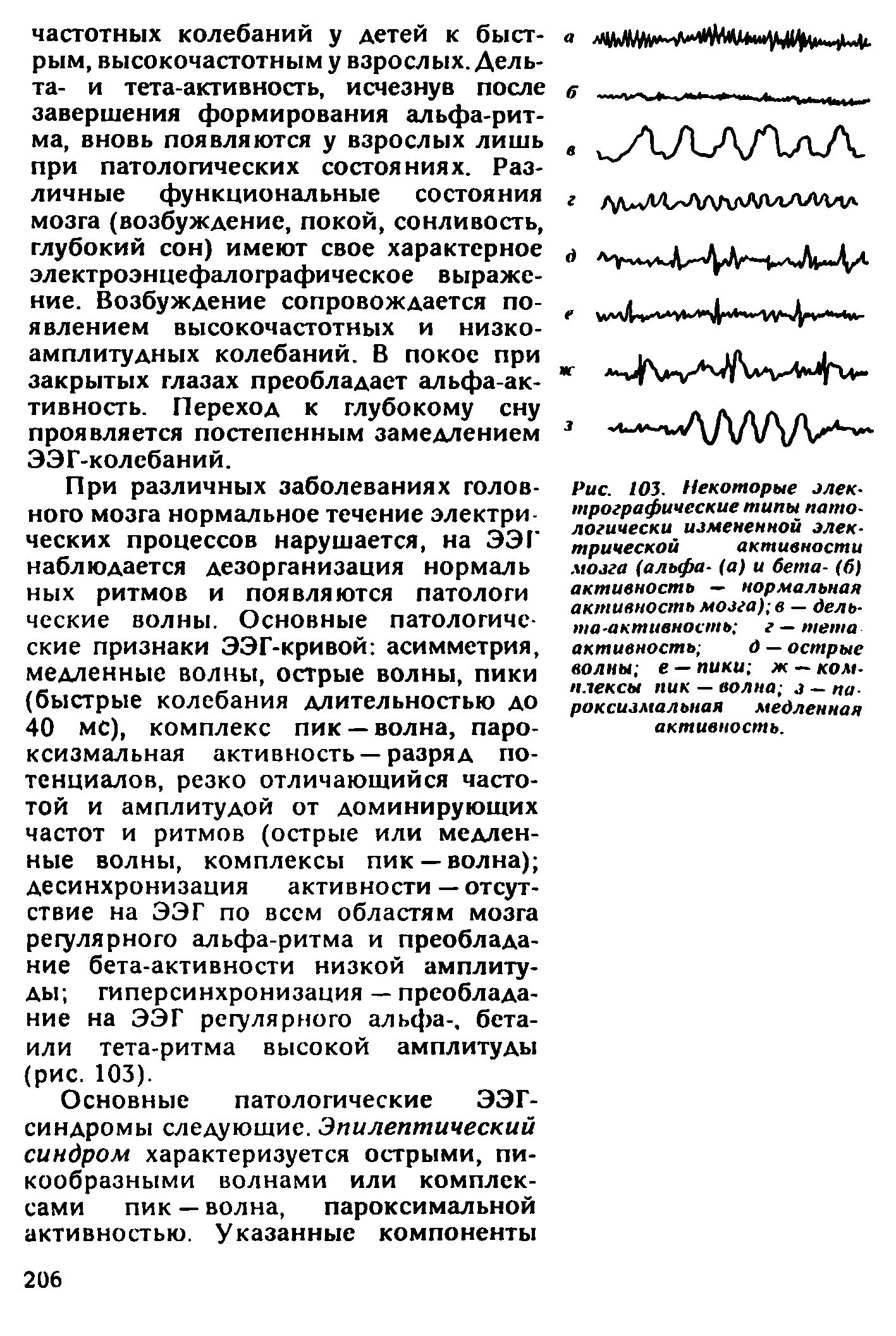 Рис. 103. Некоторые электрографические типы патологически измененной электрической активности мозга (альфа- (а) и бета- (б) активность — нормальная активность мозга) в — дельта-активность г — тета активность д — острые волны е — пики ж — комплексы пик — волна з — пароксизмальная медленная активность.