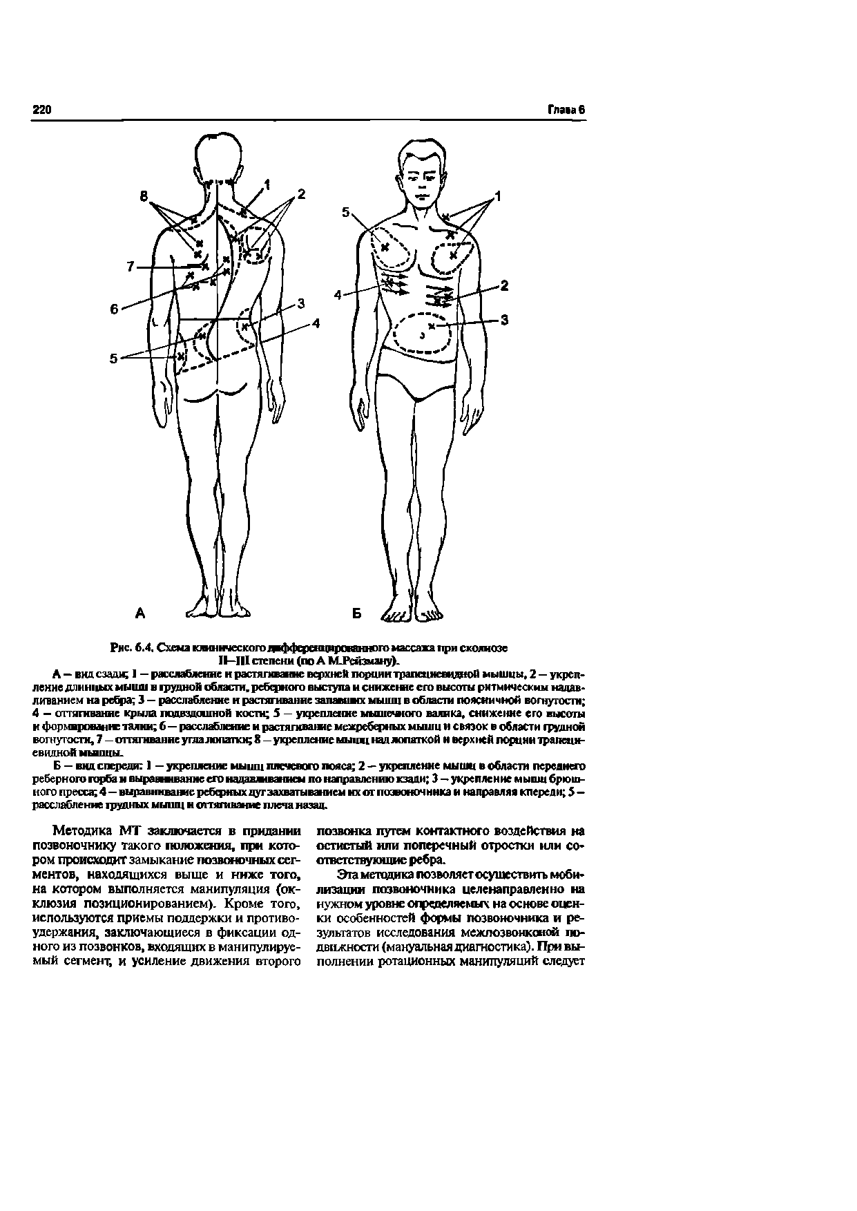 Рис. 6.4. Схема ювштескогодафференцнрсявнного массажа при сколиозе II—III степени (по А МРеквону).