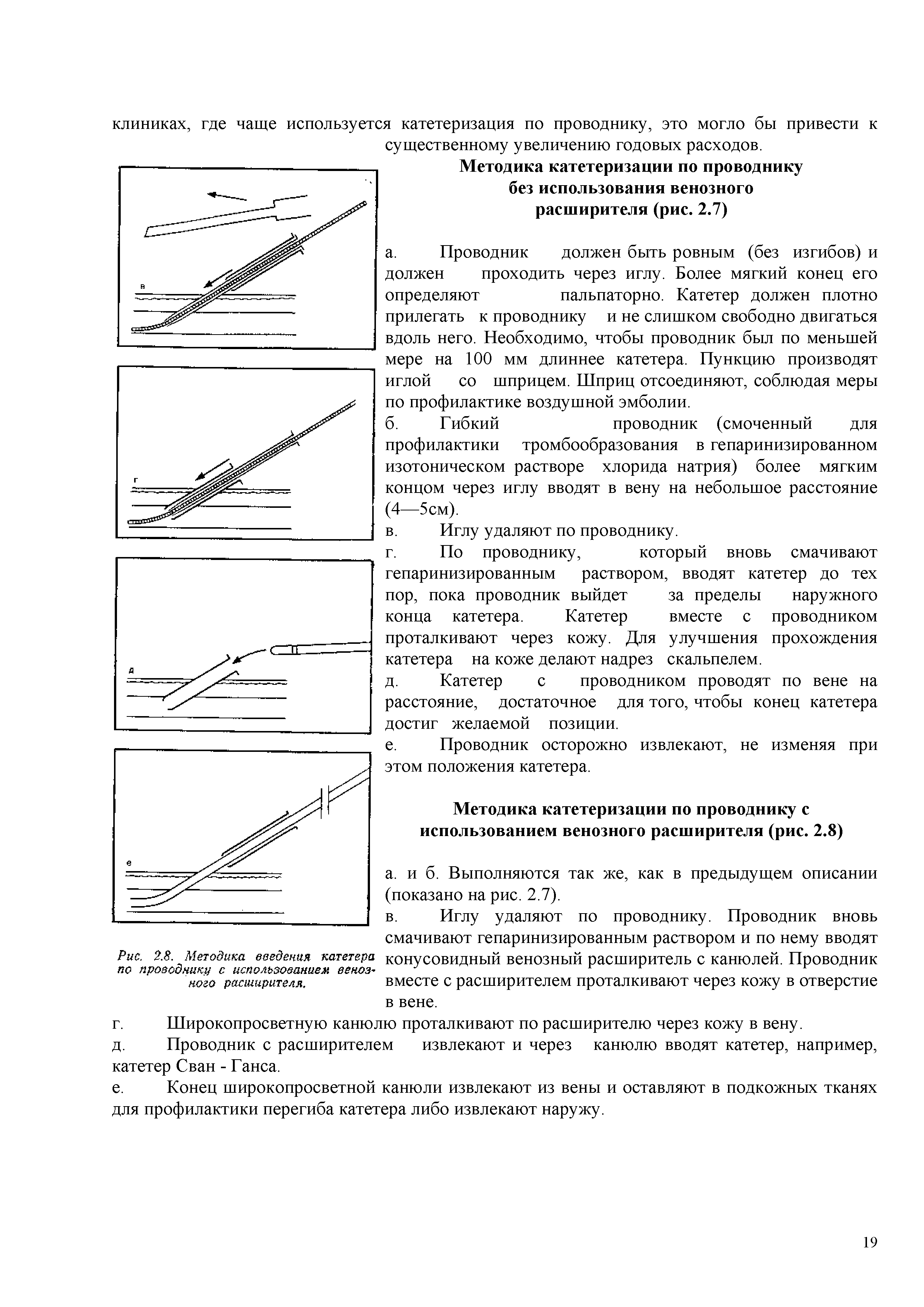 Рис. 2.8. Методика введения катетера конусовидный венозный расширитель с канюлей. Проводник по проводнику с использованием веноз-...