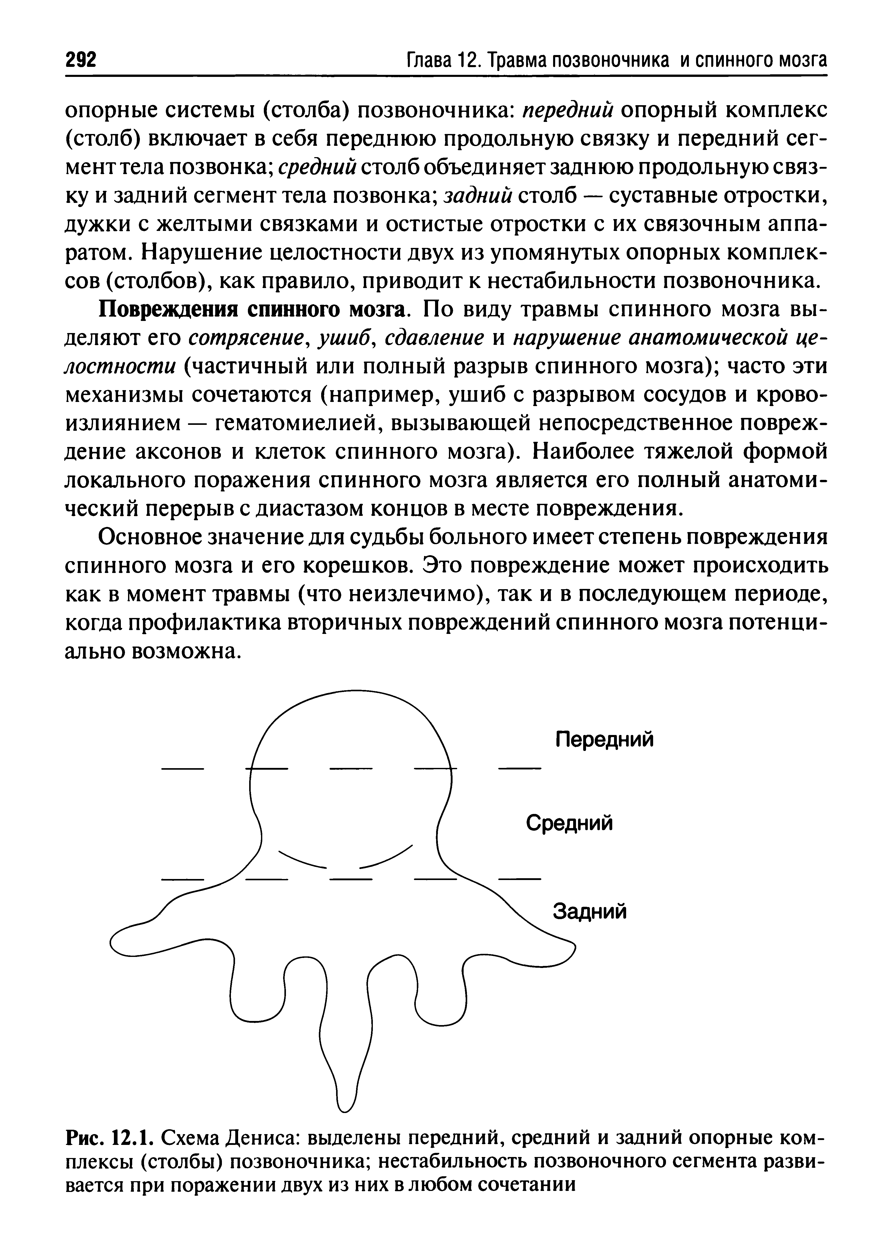 Рис. 12.1. Схема Дениса выделены передний, средний и задний опорные комплексы (столбы) позвоночника нестабильность позвоночного сегмента развивается при поражении двух из них в любом сочетании...