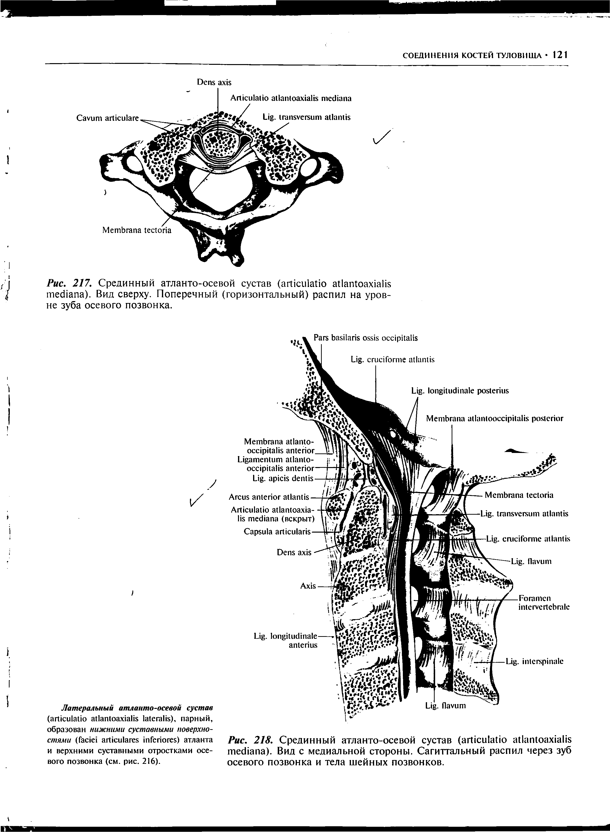 Рис. 217. Срединный атланто-осевой сустав ( ). Вид сверху. Поперечный (горизонтальный) распил на уровне зуба осевого позвонка.