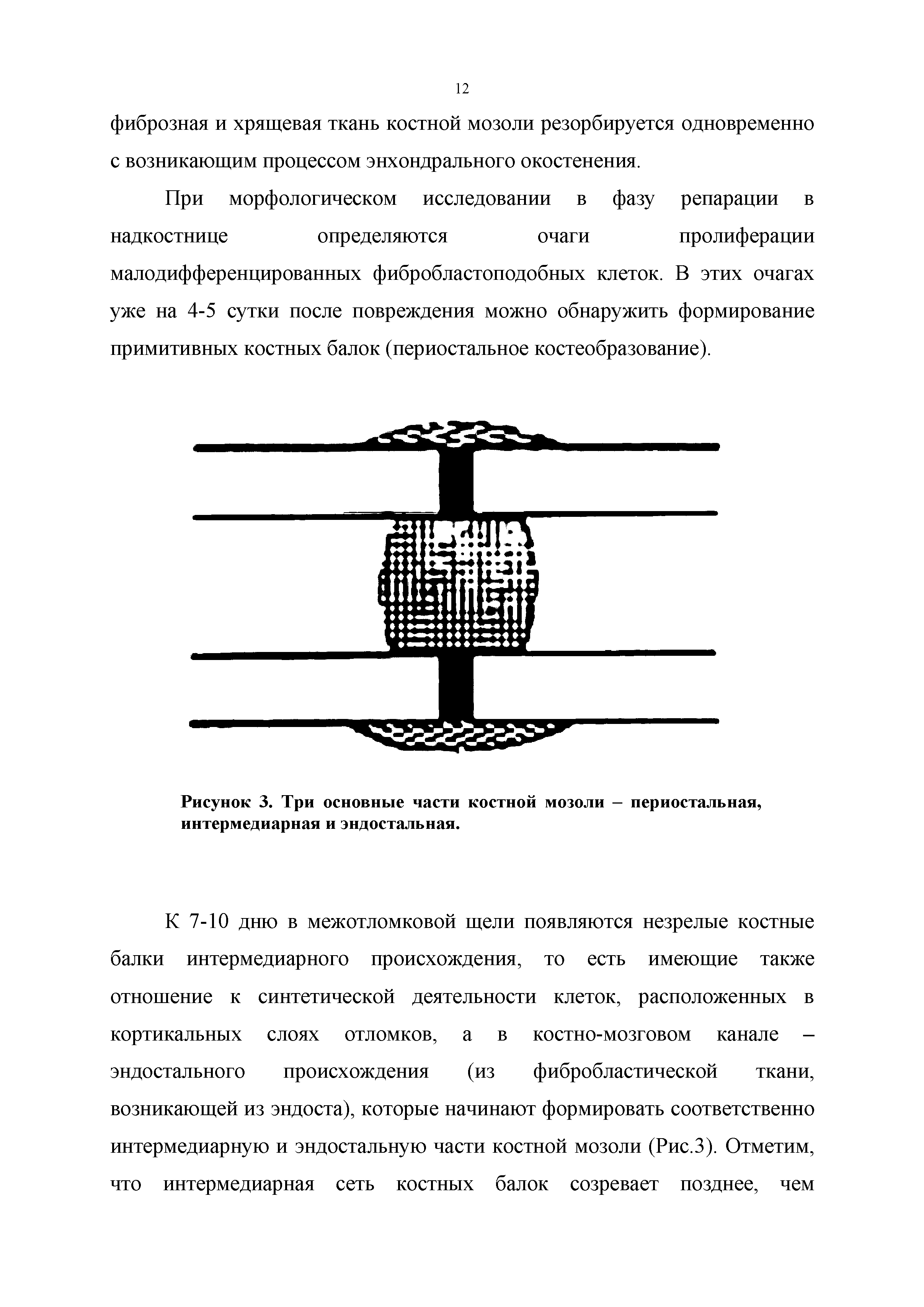 Рисунок 3. Три основные части костной мозоли — периостальная, интермедиарная и эндостальная.