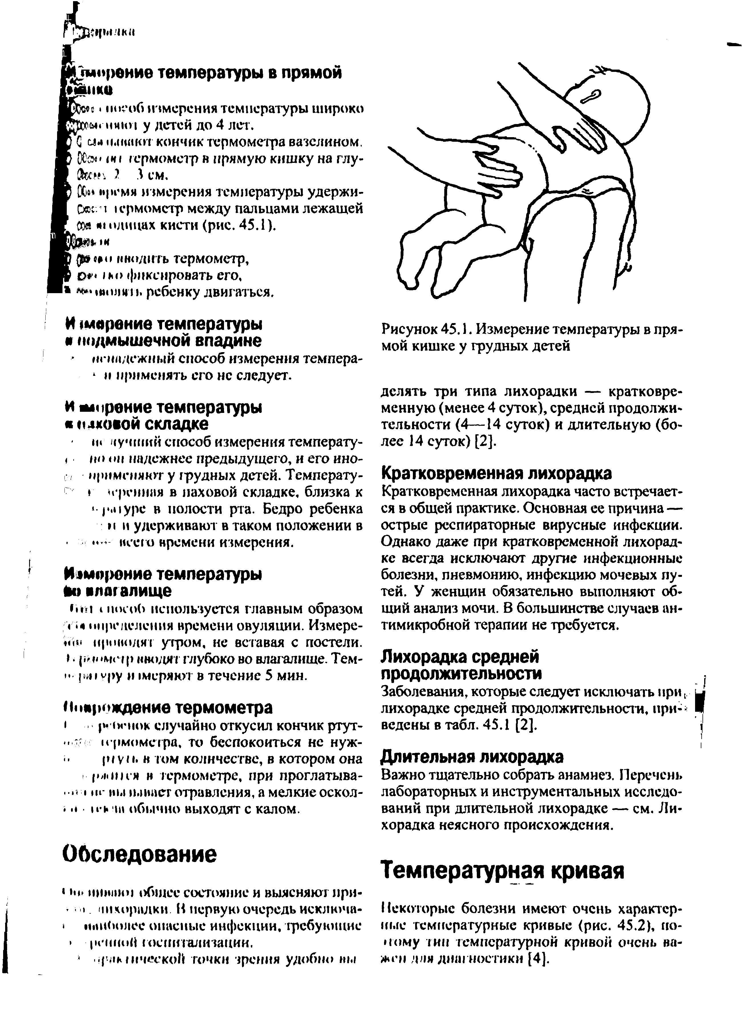 Рисунок 45.1. Измерение температуры в прямой кишке у грудных детей...