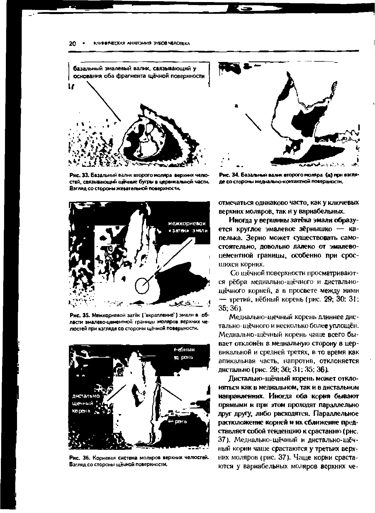 Рис. 34. База/ьный валик второго моляра (а) при взгляде со стороны медиально-контактной поверхности.