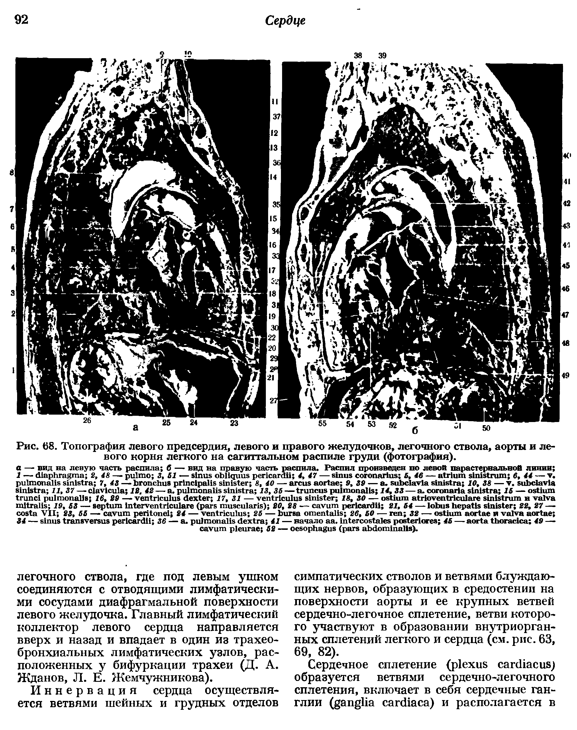 Рис. 68. Топография левого предсердия, левого и правого желудочков, легочного ствола, аорты и левого корня легкого на сагиттальном распиле груди (фотография).