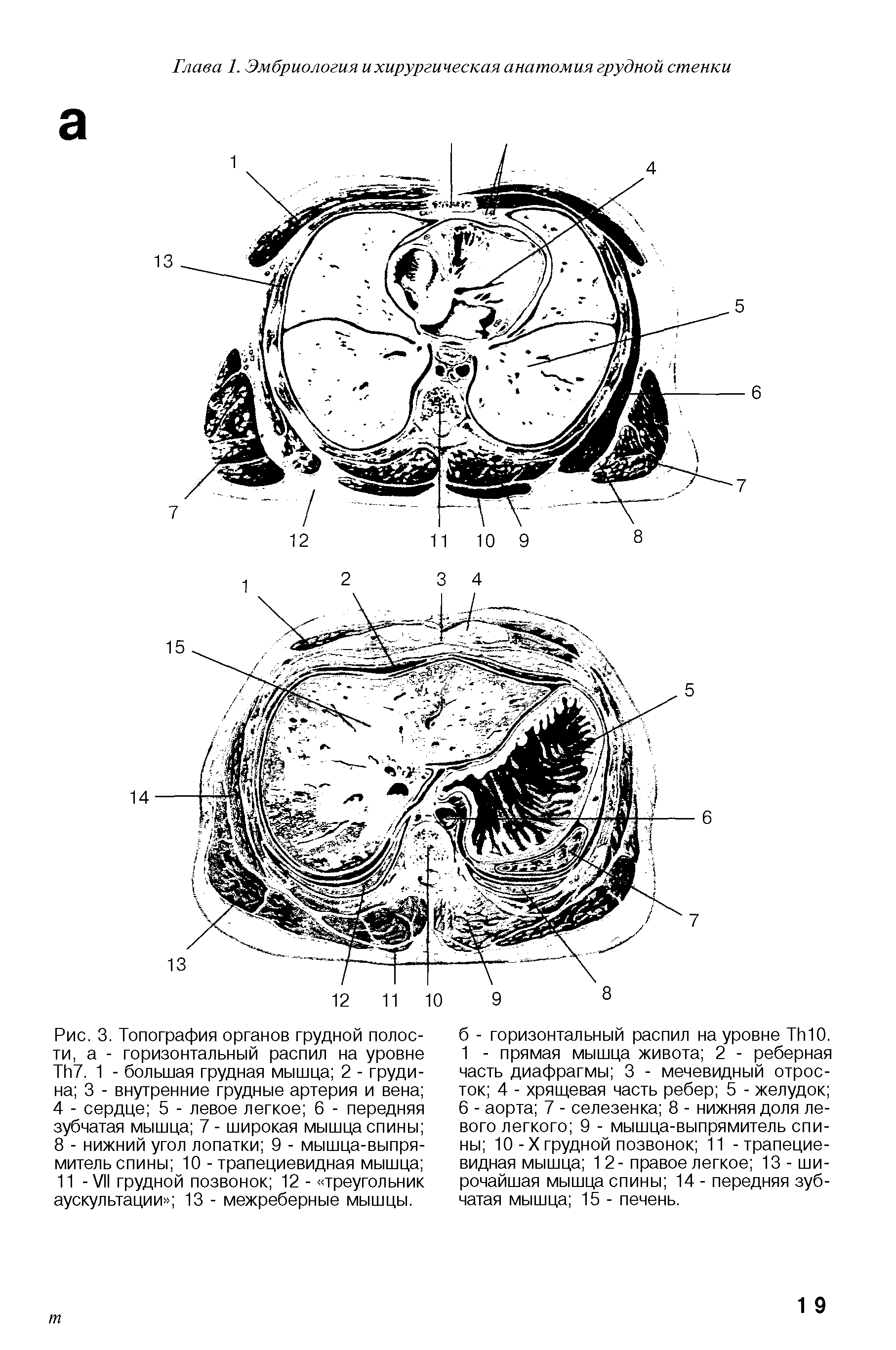 Рис. 3. Топография органов грудной полости, а - горизонтальный распил на уровне ТИ7. 1 - большая грудная мышца 2 - грудина 3 - внутренние грудные артерия и вена 4 - сердце 5 - левое легкое 6 - передняя зубчатая мышца 7 - широкая мышца спины 8 - нижний угол лопатки 9 - мышца-выпрямитель спины 10 - трапециевидная мышца 11 -VII грудной позвонок 12 - треугольник аускультации 13 - межреберные мышцы.