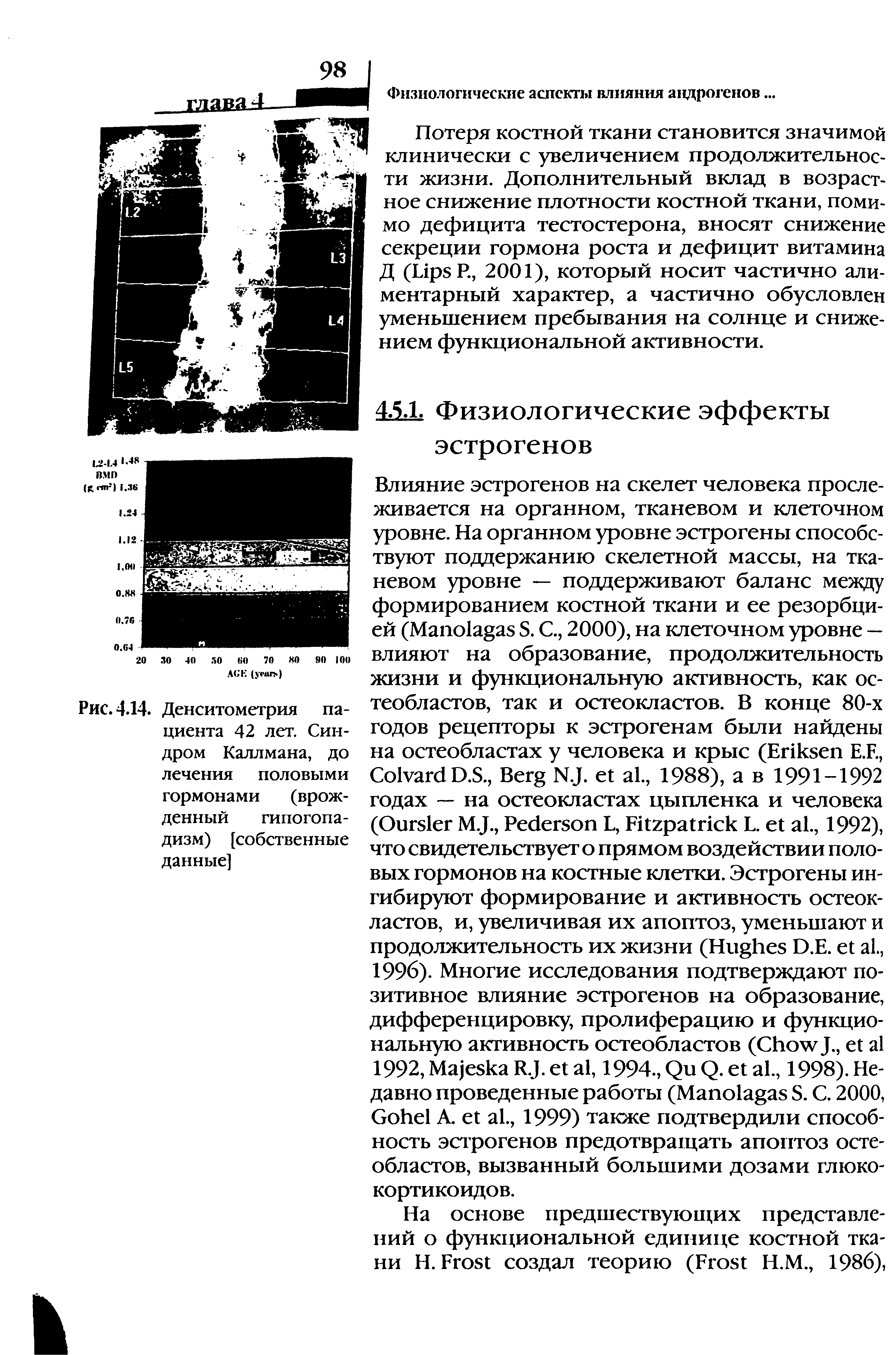 Рис. 4.14. Денситометрия пациента 42 лет. Синдром Каллмана, до лечения половыми гормонами (врожденный гипогопа-дизм) [собственные данные]...