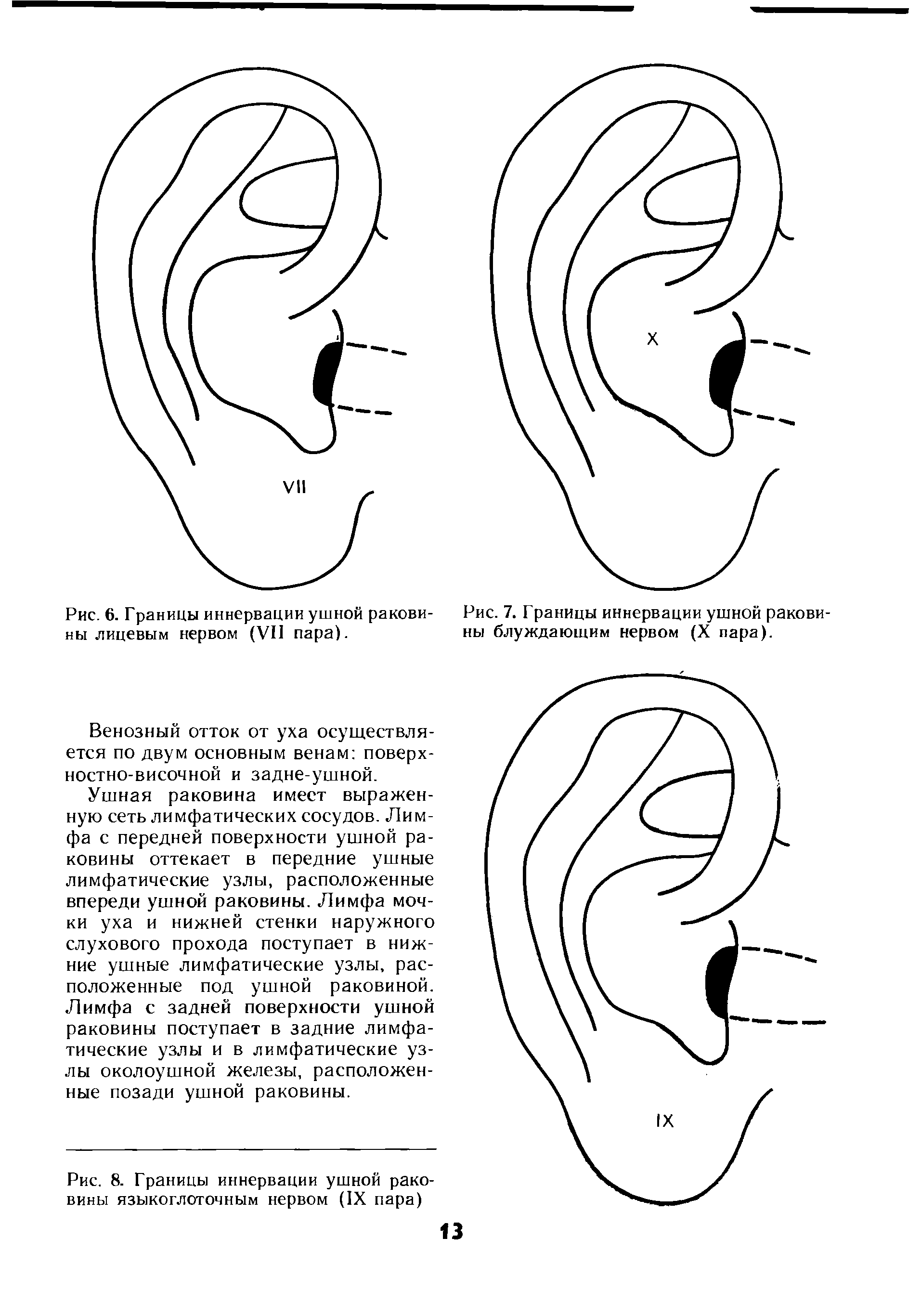 Рис. 7. Границы иннервации ушной раковины блуждающим нервом (X пара).