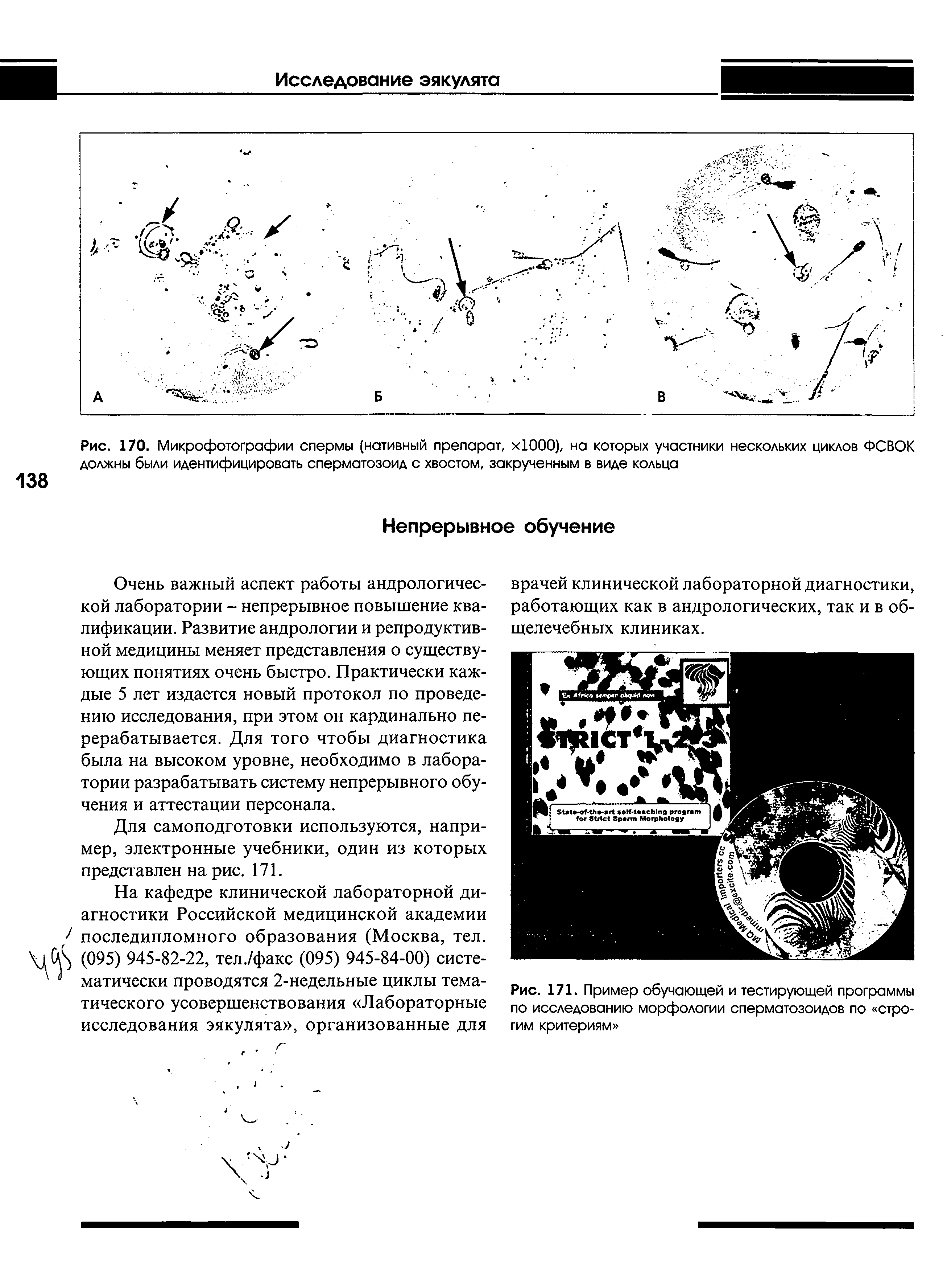 Рис. 170. Микрофотографии спермы (нативный препарат, хЮОО), на которых участники нескольких циклов ФСВОК должны были идентифицировать сперматозоид с хвостом, закрученным в виде кольца...