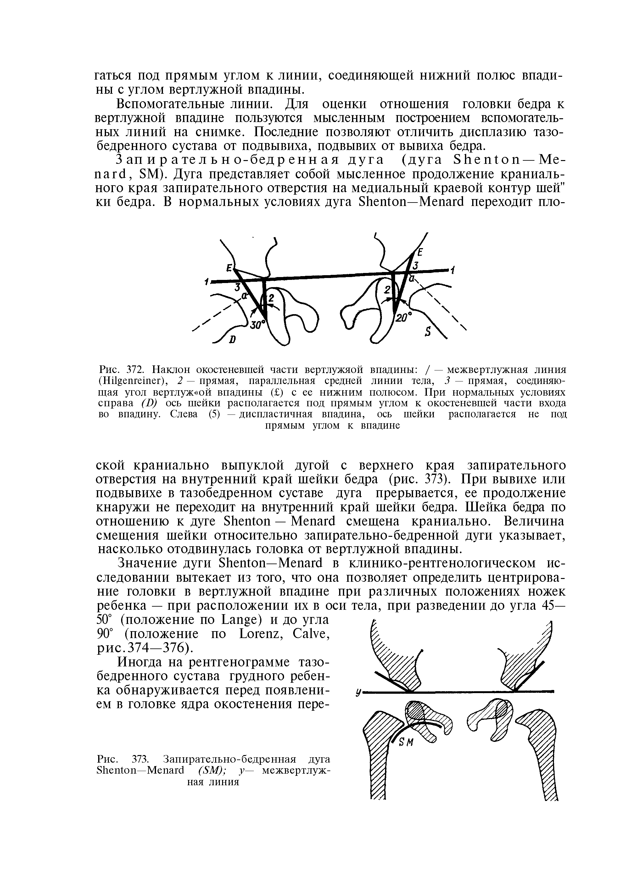 Рис. 373. Запирательно-бедренная дуга S —M (SM) у— межвертлужная линия...