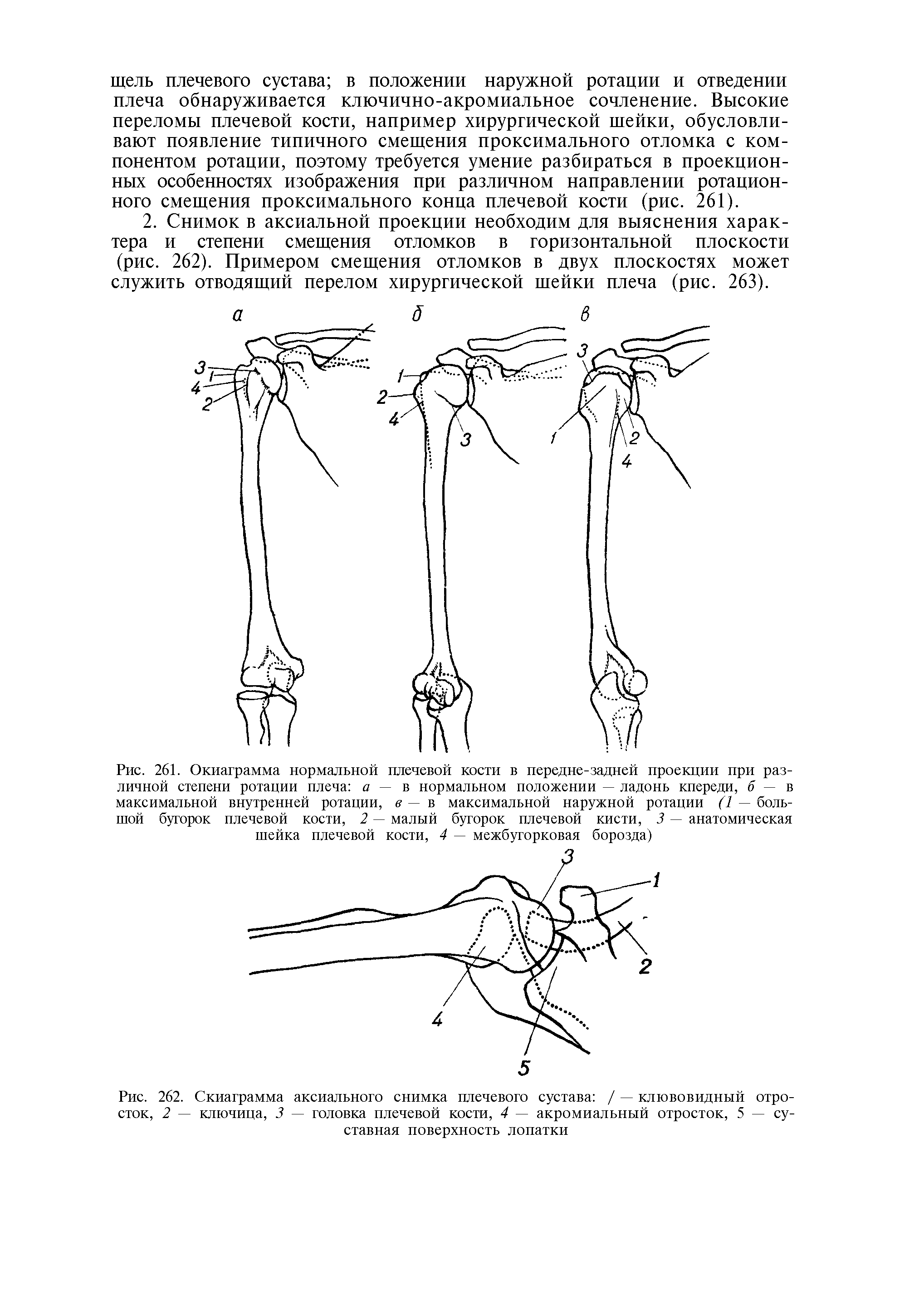 Рис. 262. Скиаграмма аксиального снимка плечевого сустава / — клювовидный отросток, 2 — ключица, 3 — головка плечевой кости, 4 — акромиальный отросток, 5 — суставная поверхность лопатки...