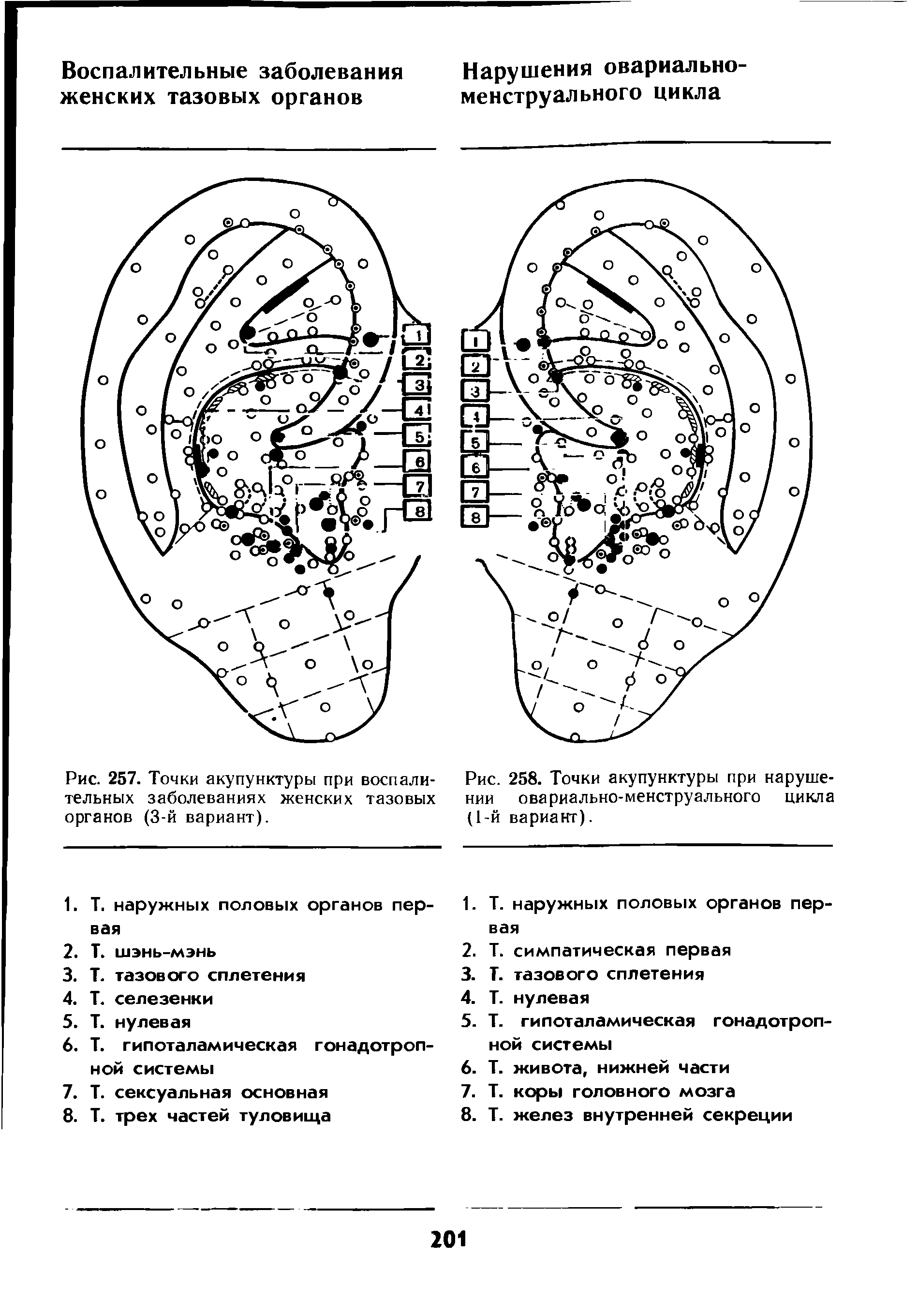 Рис. 258. Точки акупунктуры при нарушении овариально-менструального цикла (1-й вариант).