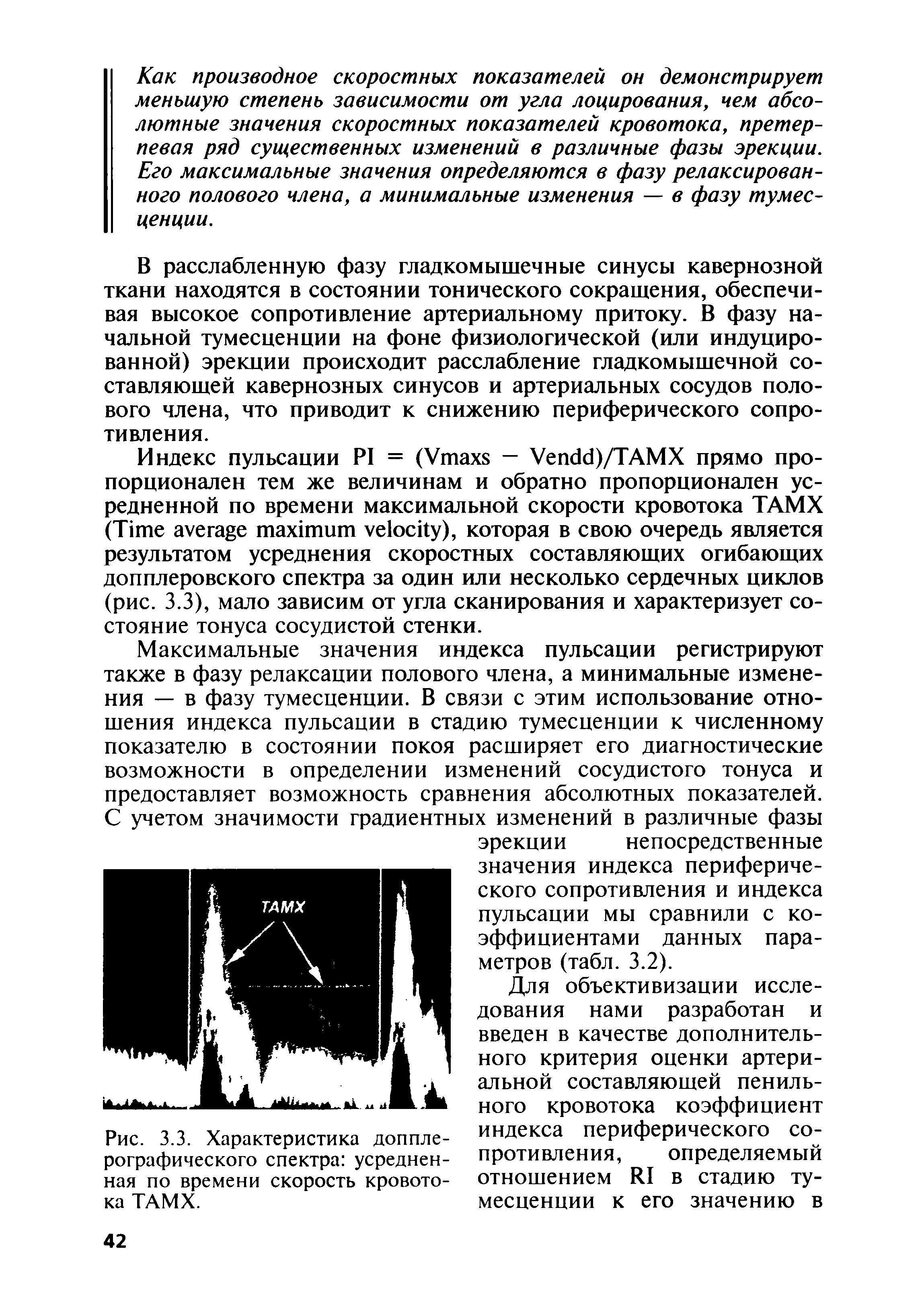 Рис. 3.3. Характеристика допплерографического спектра усредненная по времени скорость кровотока ТАМХ.