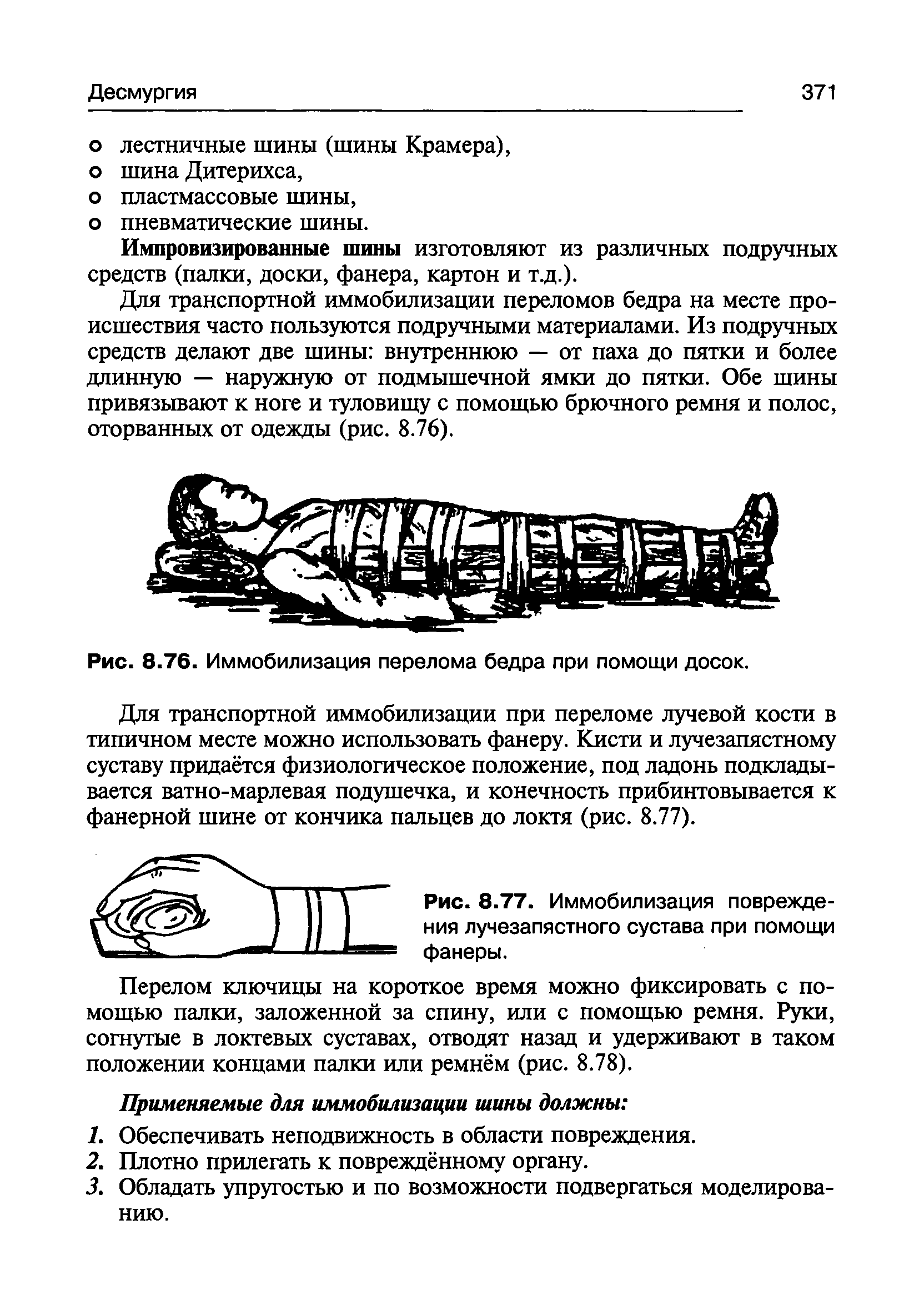 Рис. 8.77. Иммобилизация повреждения лучезапястного сустава при помощи фанеры.