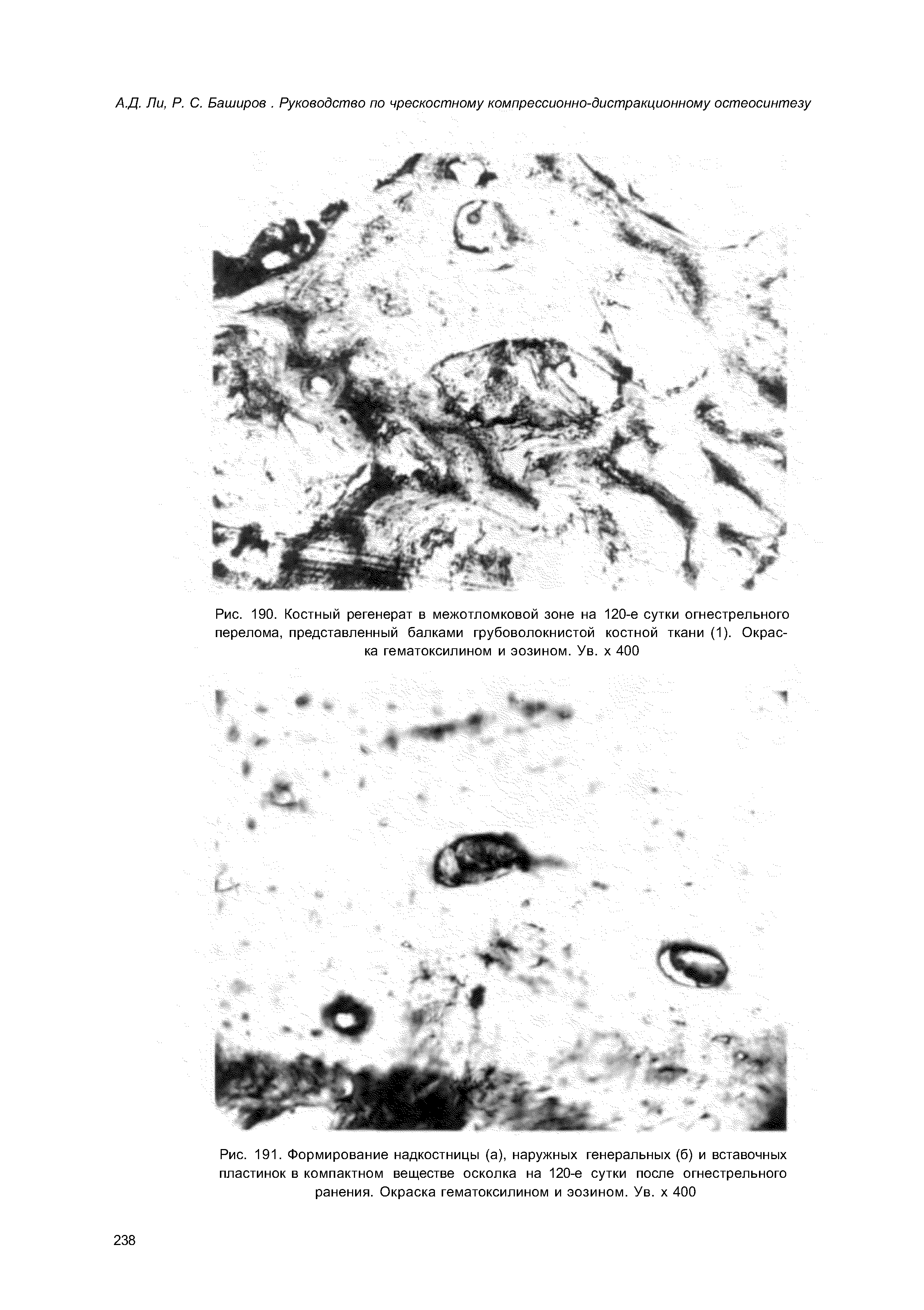 Рис. 191. Формирование надкостницы (а), наружных генеральных (б) и вставочных пластинок в компактном веществе осколка на 120-е сутки после огнестрельного ранения. Окраска гематоксилином и эозином. Ув. х 400...