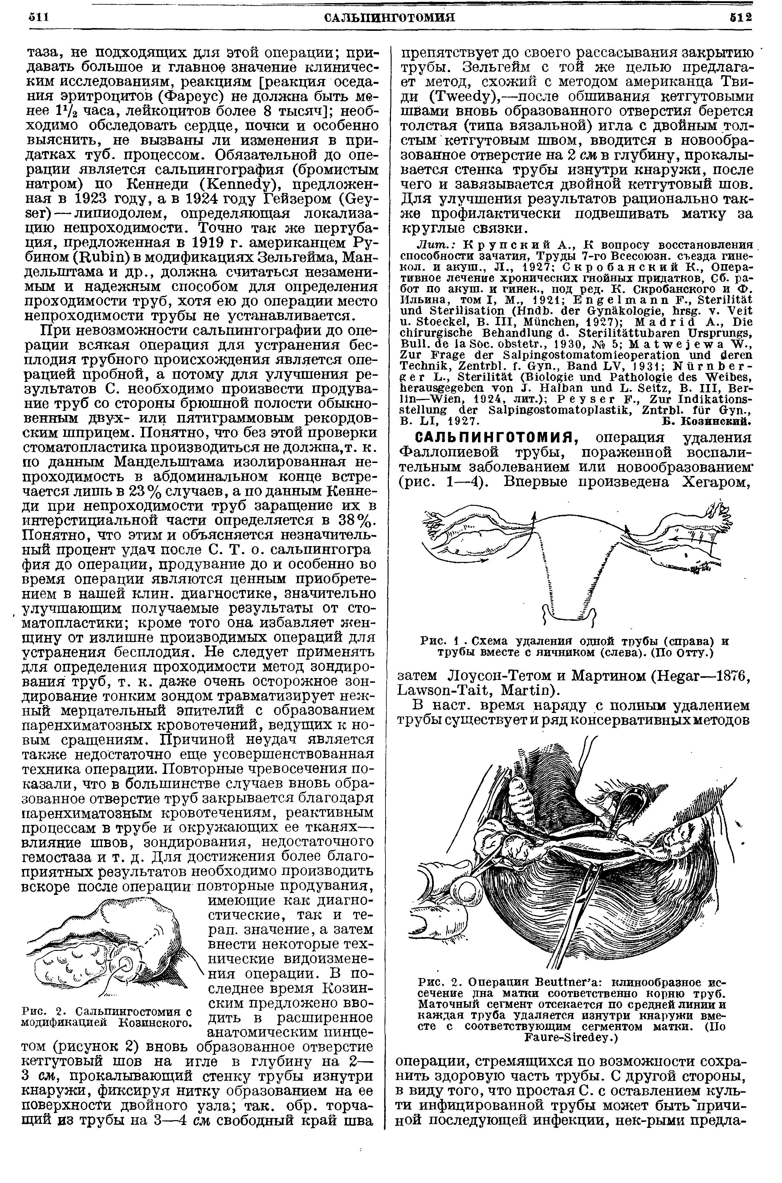 Рис. 2. Операция ВеиПпег а клинообразное иссечение дна матки соответственно корню труб. Маточный сегмент отсекается по средней линии и каждая труба удаляется изнутри кнаружи вместе с соответствующим сегментом матки. (По Гаиге-Зп еу.)...