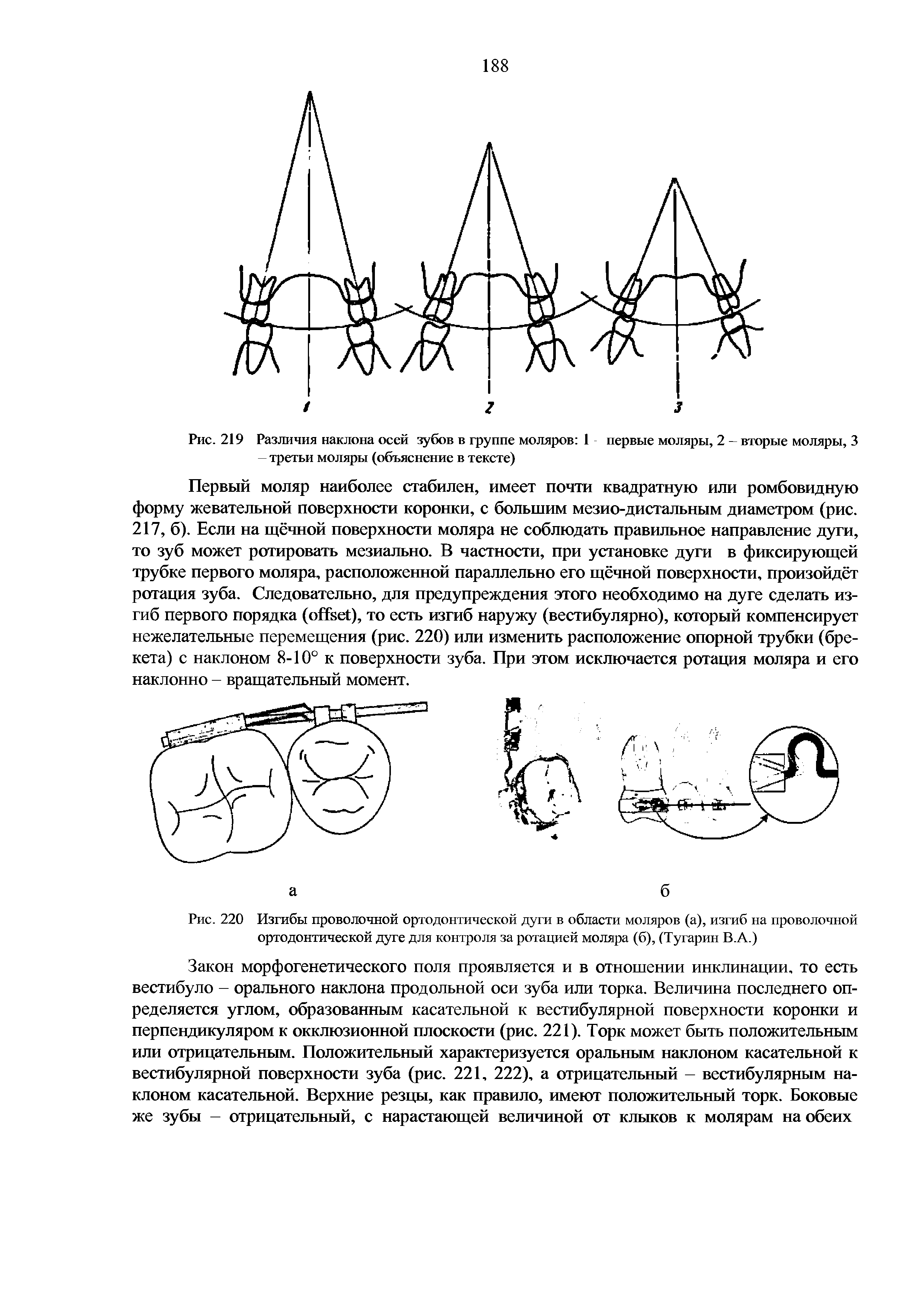 Рис. 220 Изгибы проволочной ортодонтической дуги в области моляров (а), изгиб на проволочной ортодонтической дуге для контроля за ротацией моляра (б), (Тугарин В.А.)...