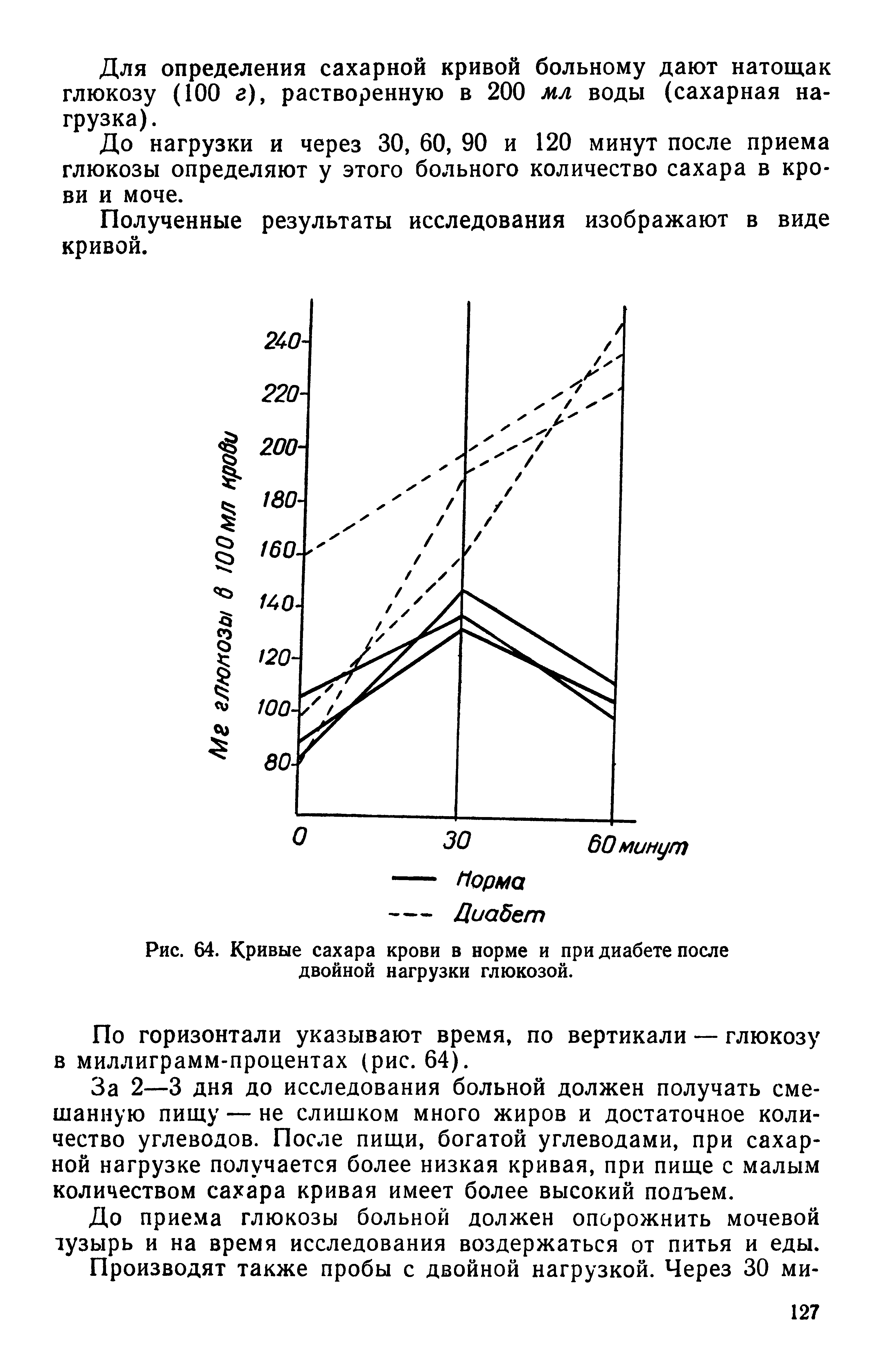 Рис. 64. Кривые сахара крови в норме и при диабете после двойной нагрузки глюкозой.