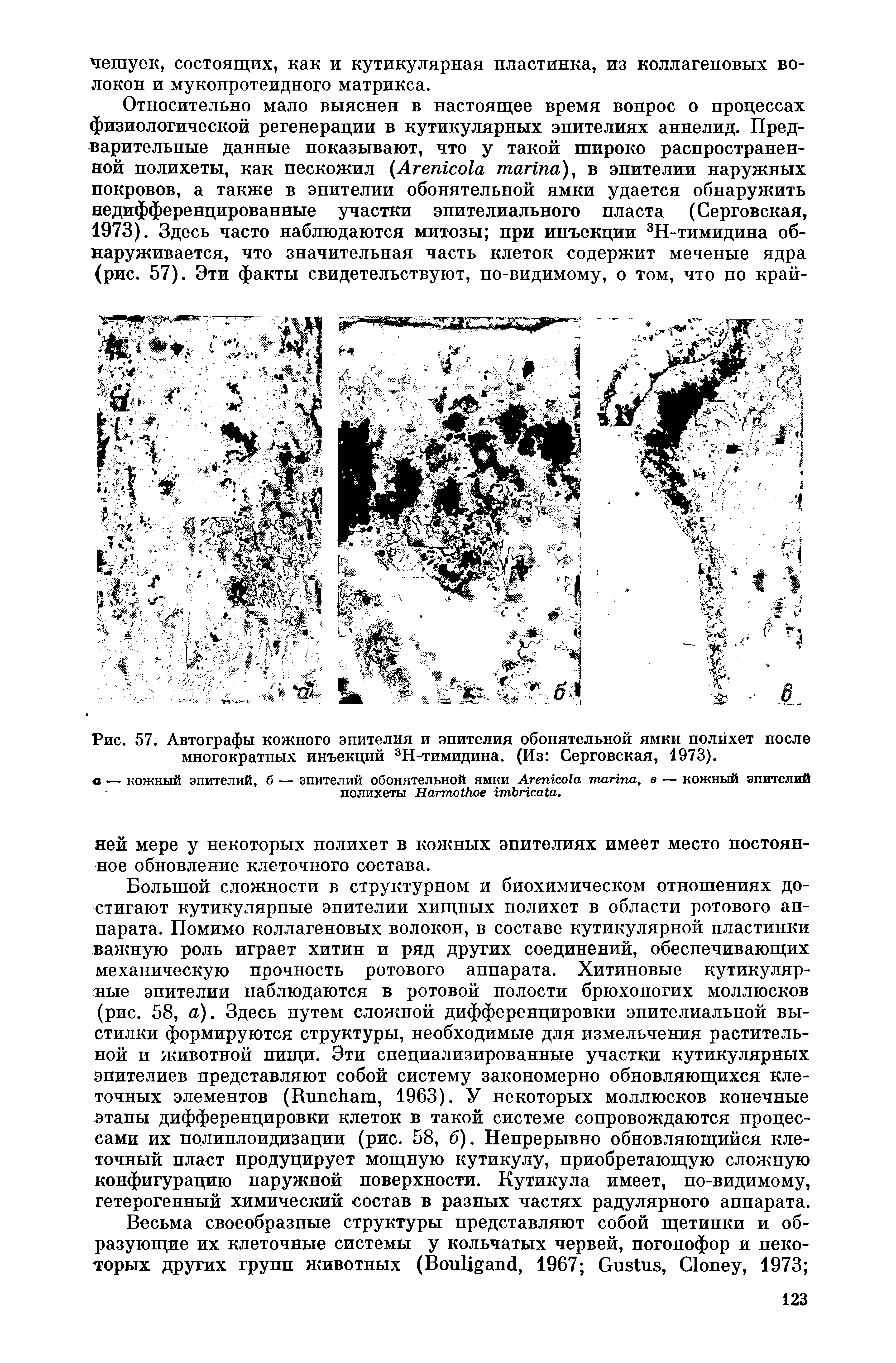 Рис. 57. Автографы кожного эпителия и эпителия обонятельной ямки полйхет после многократных инъекций 3Н-тимидина. (Из Серговская, 1973).