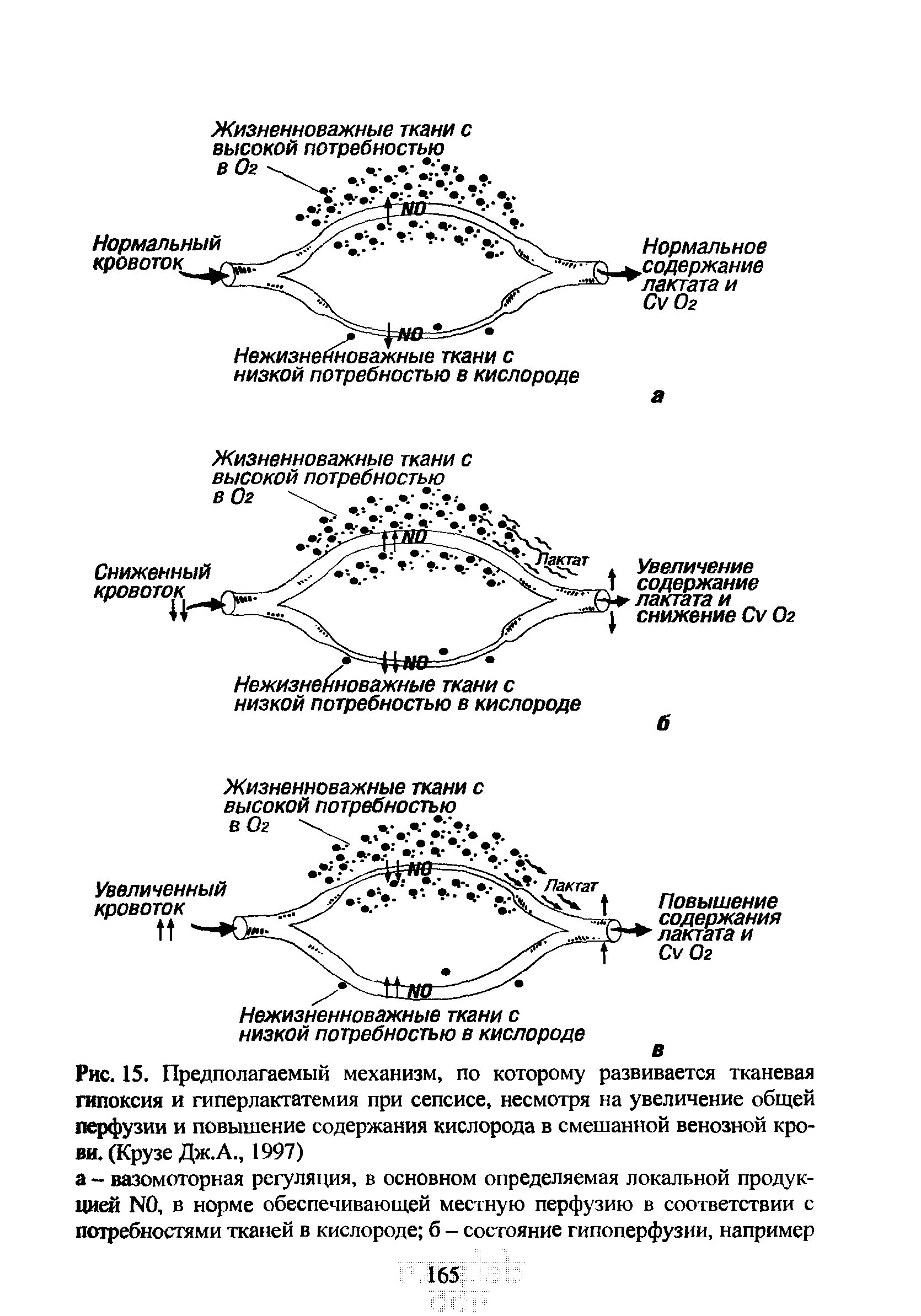 Рис. 15. Предполагаемый механизм, по которому развивается тканевая гипоксия и гиперлактатемия при сепсисе, несмотря на увеличение общей перфузии и повышение содержания кислорода в смешанной венозной крови. (Крузе Дж. А., 1997)...
